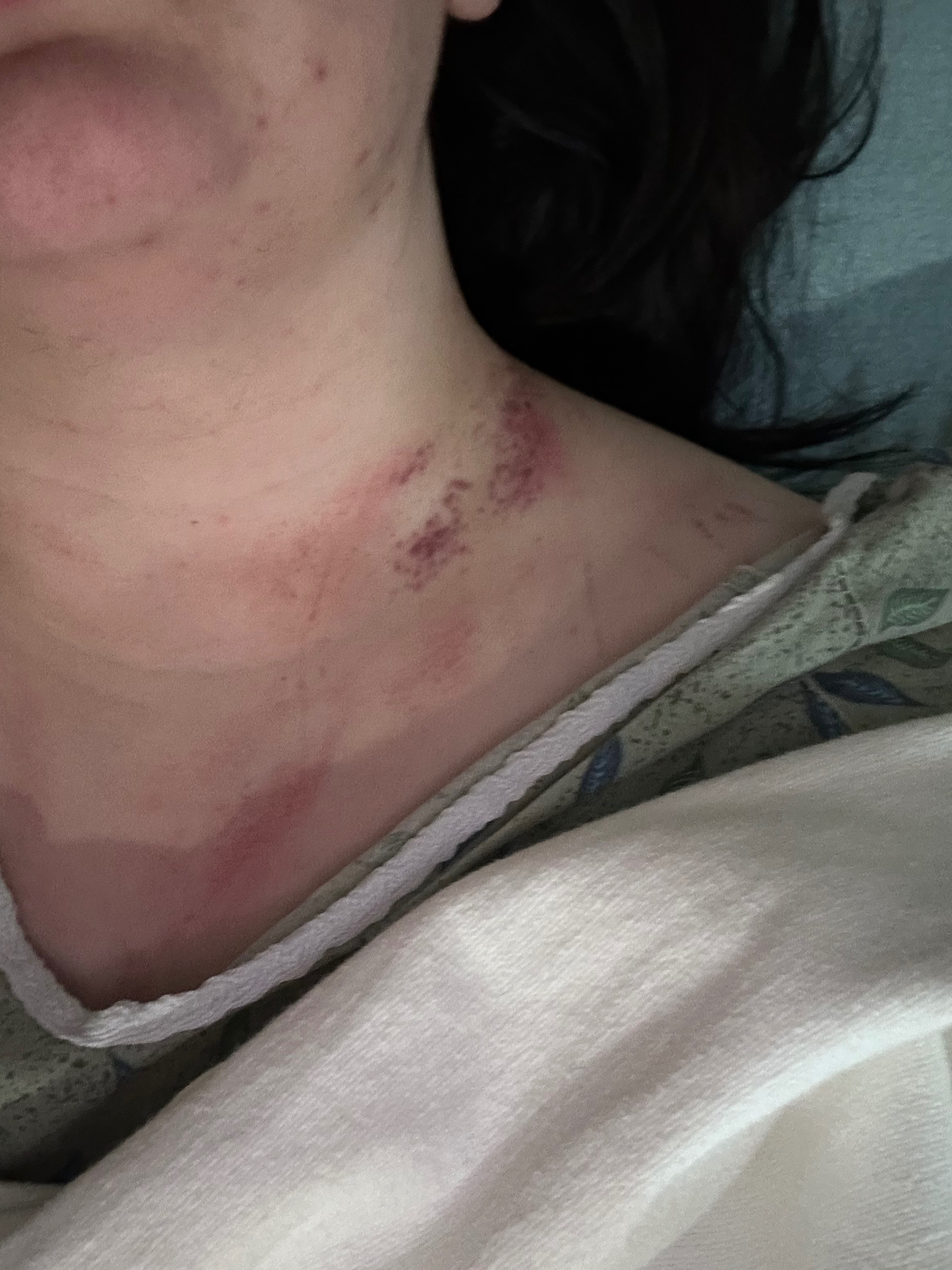 Help Rhiannon Moody Recover from Car Accident campaign photo, 2 of 6