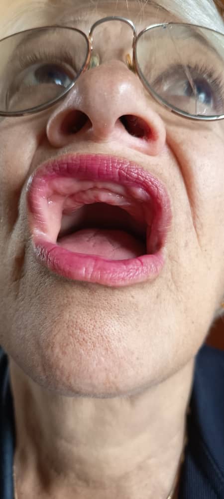 Ayuda para completar la prótesis dental de mi mamá campaign photo, 4 of 8