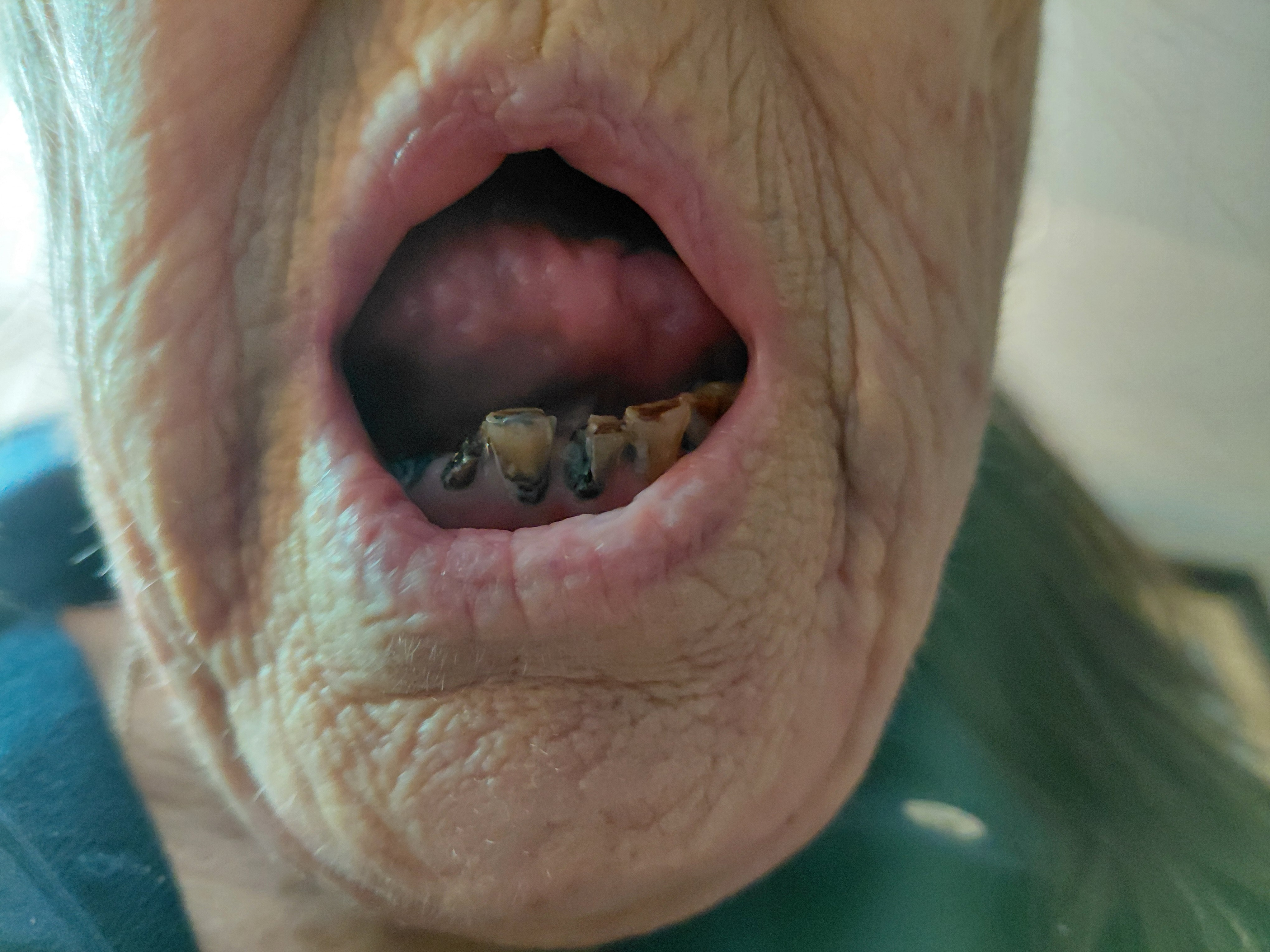 Help Paula Smile Again After Surgery campaign photo, 4 of 5