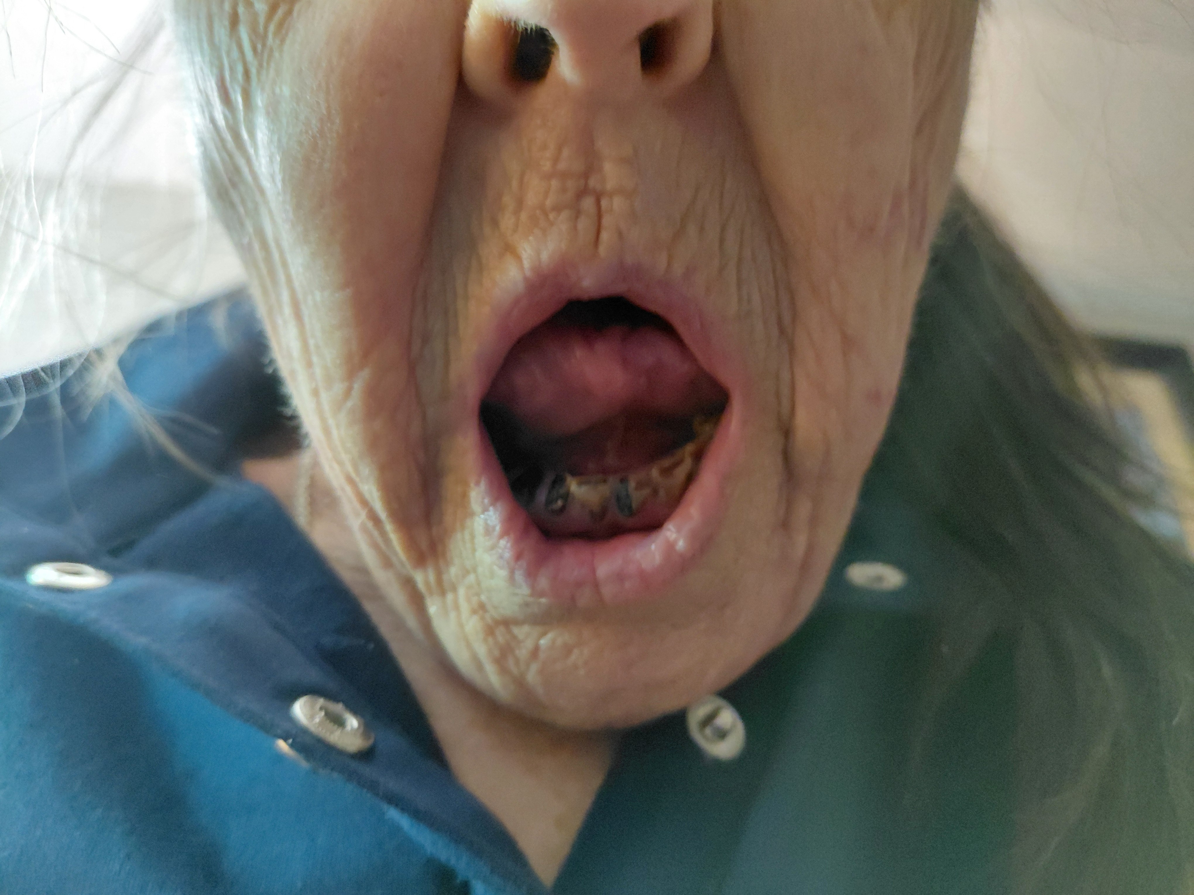 Help Paula Smile Again After Surgery campaign photo, 2 of 5