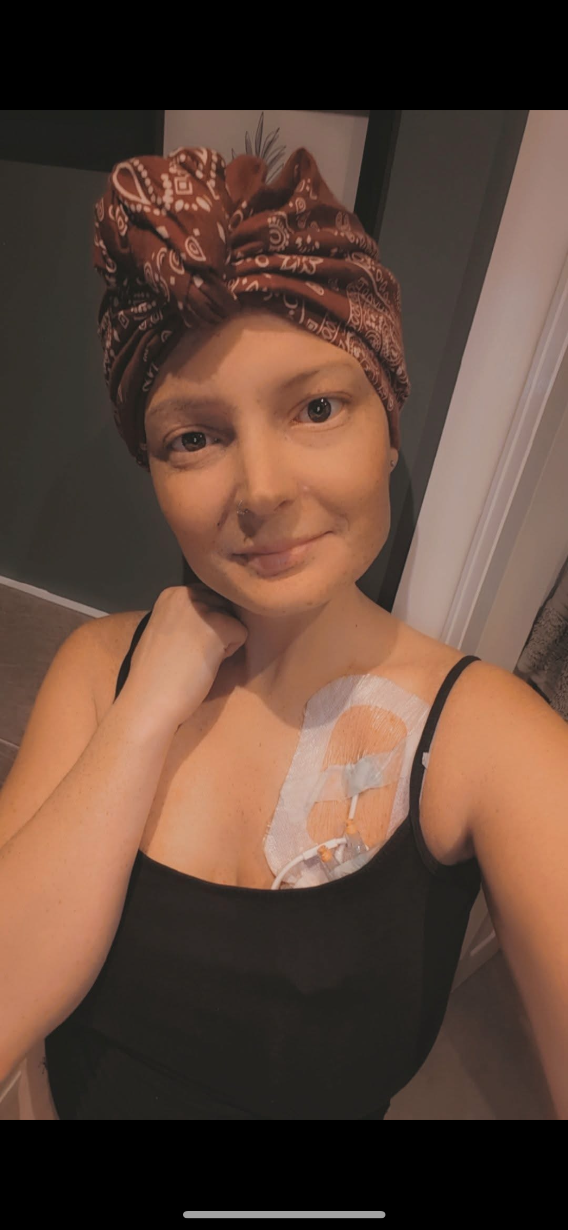 Incredible woman fights bone cancer whilst raising a family. campaign photo, 6 of 8