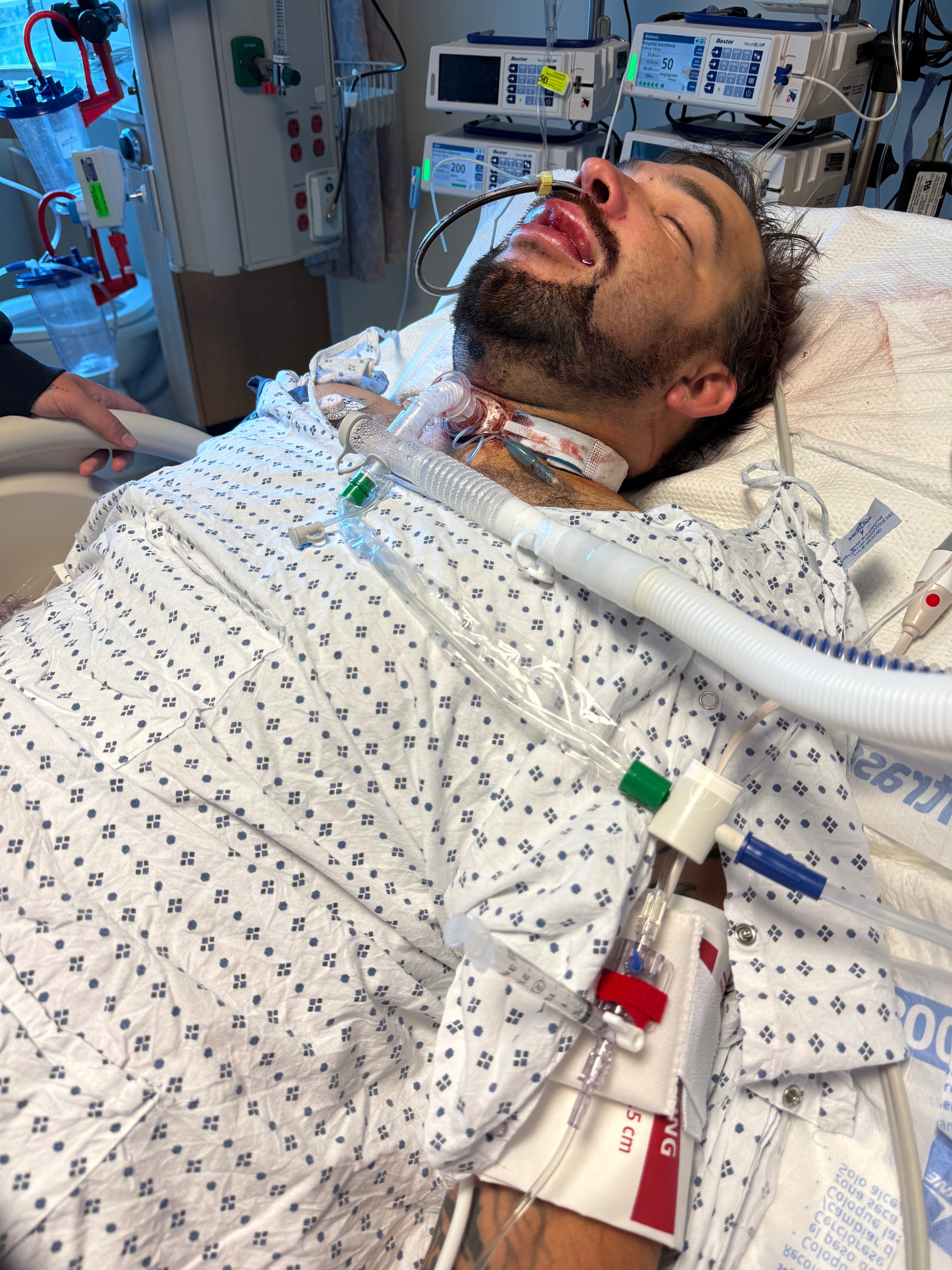 He survived attempting to take his life ! campaign photo, 5 of 7