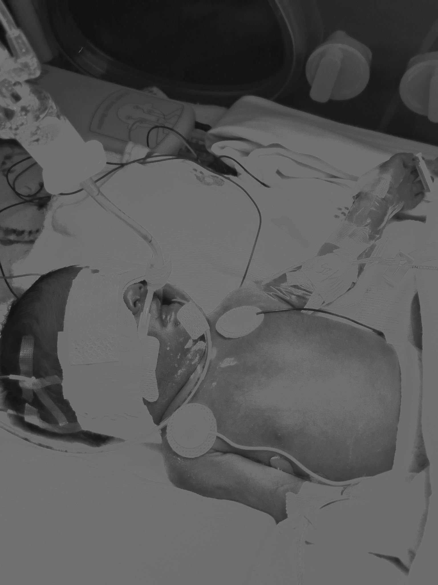 Help Us Honor Skyzlee's Memory campaign photo, 6 of 7