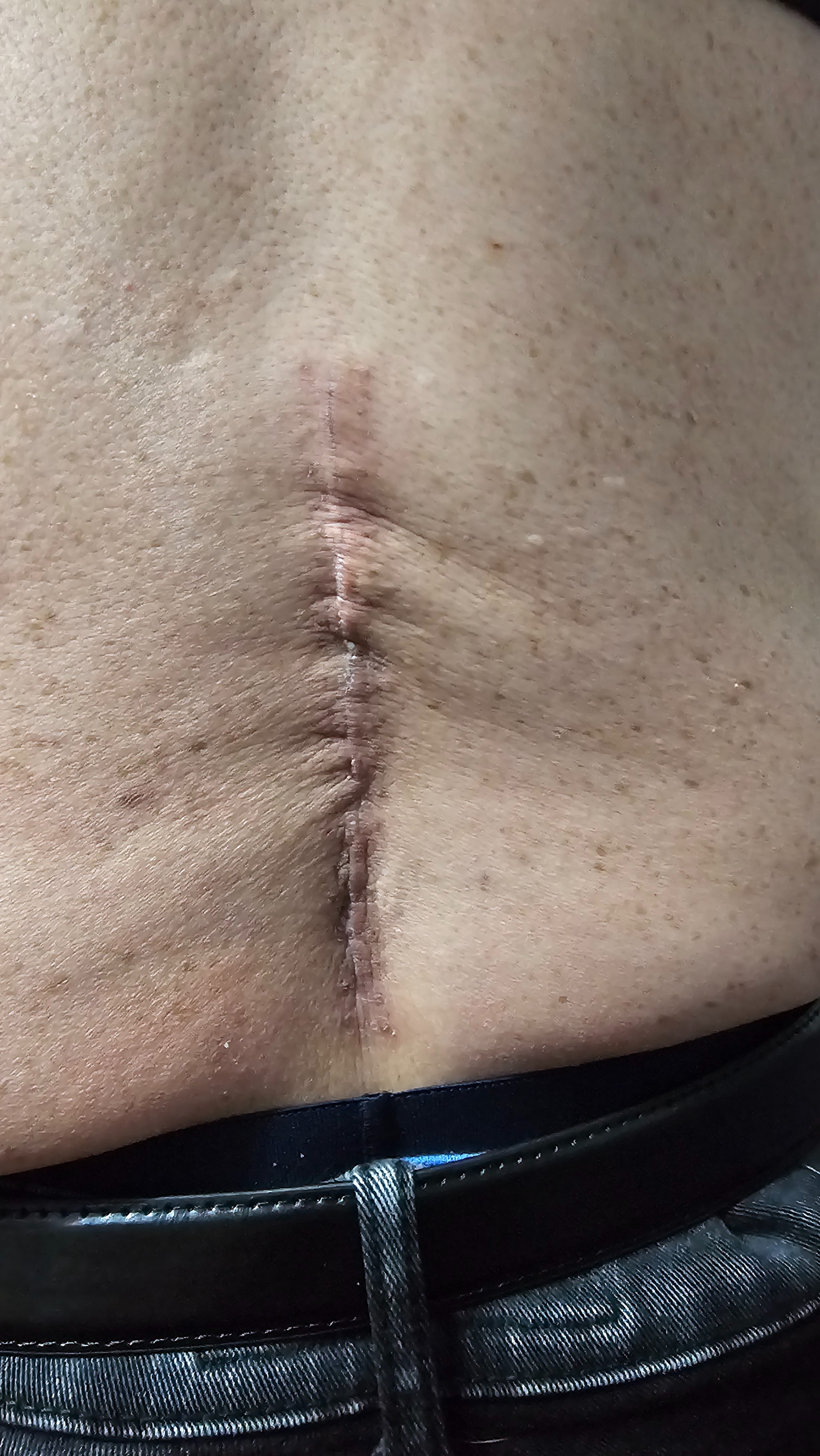 Help Stewart Recover from Spine Surgery campaign photo, 4 of 7