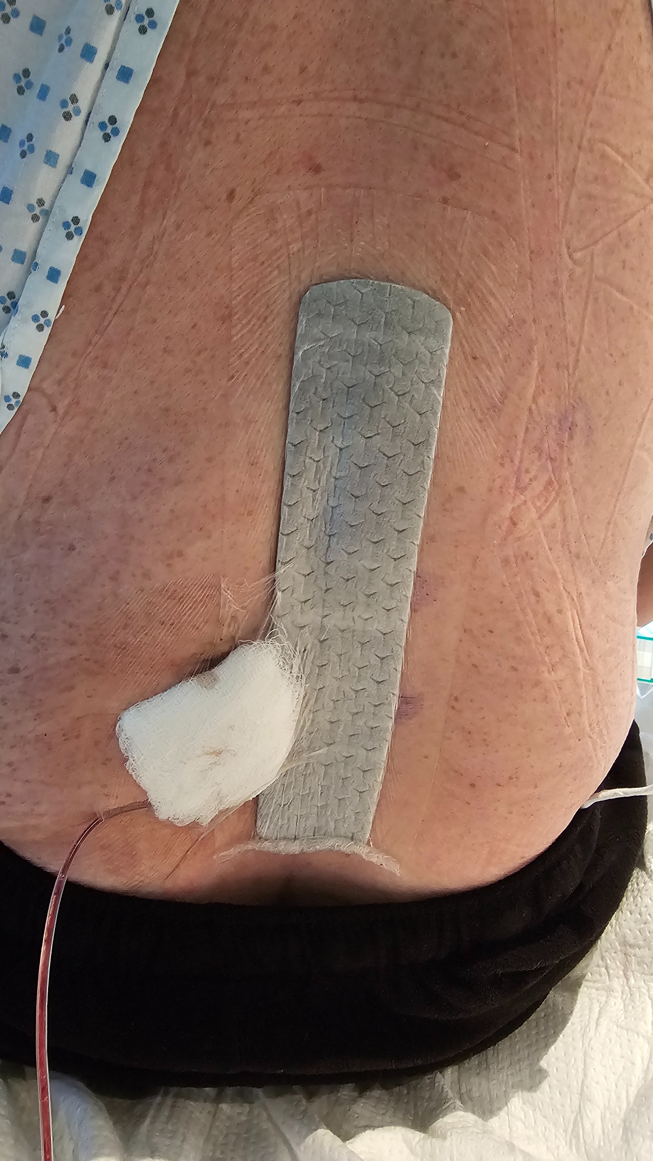 Help Stewart Recover from Spine Surgery campaign photo, 5 of 7