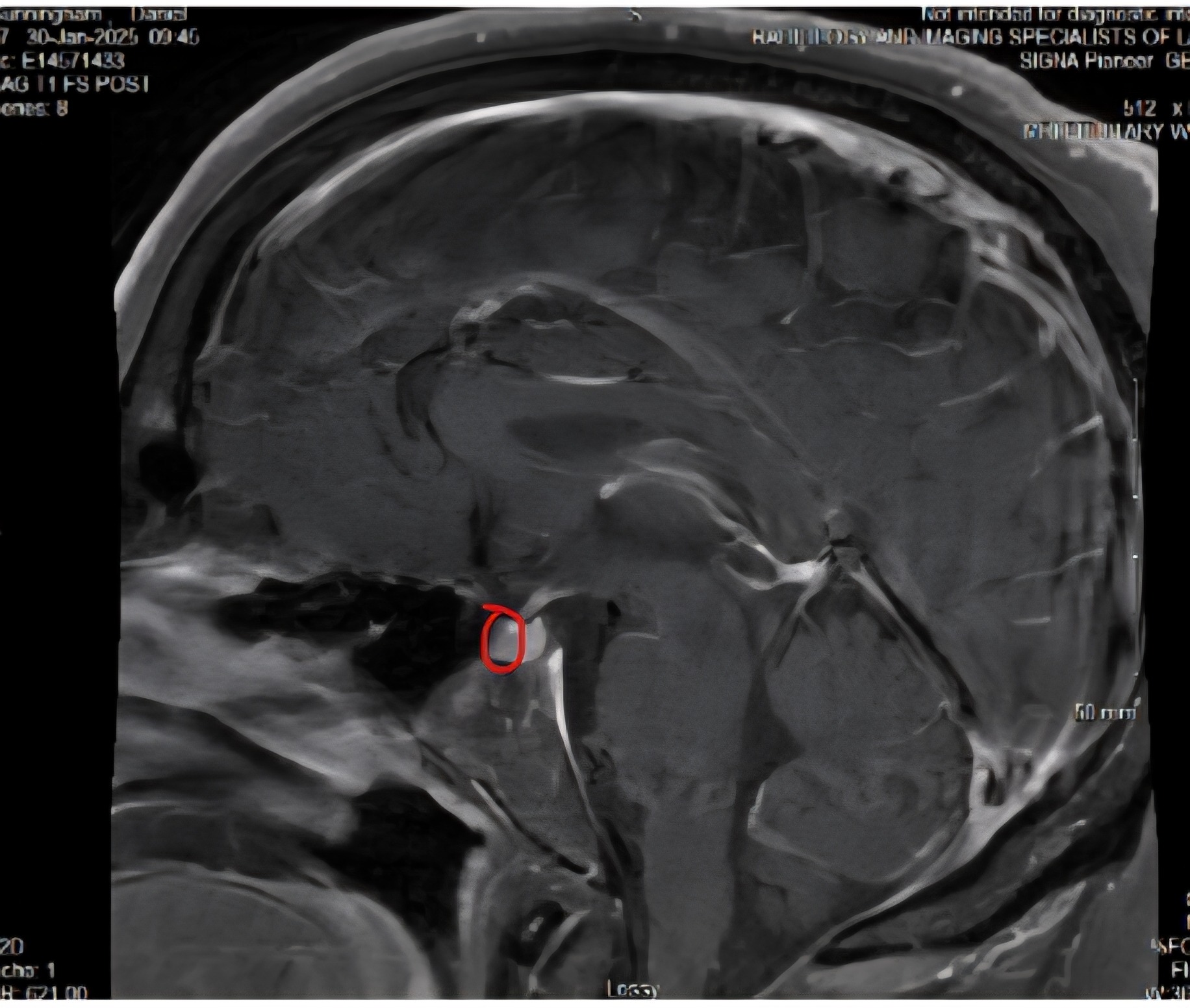 Hope for Healing: Support My Brain & Back Surgery Journey campaign photo, 2 of 5