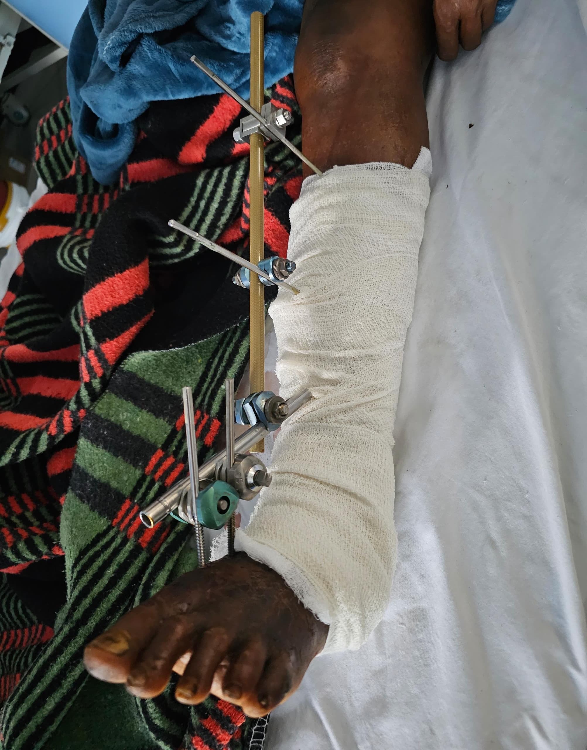 Surgery for Maasai Mama in Tanzania campaign photo, 2 of 5