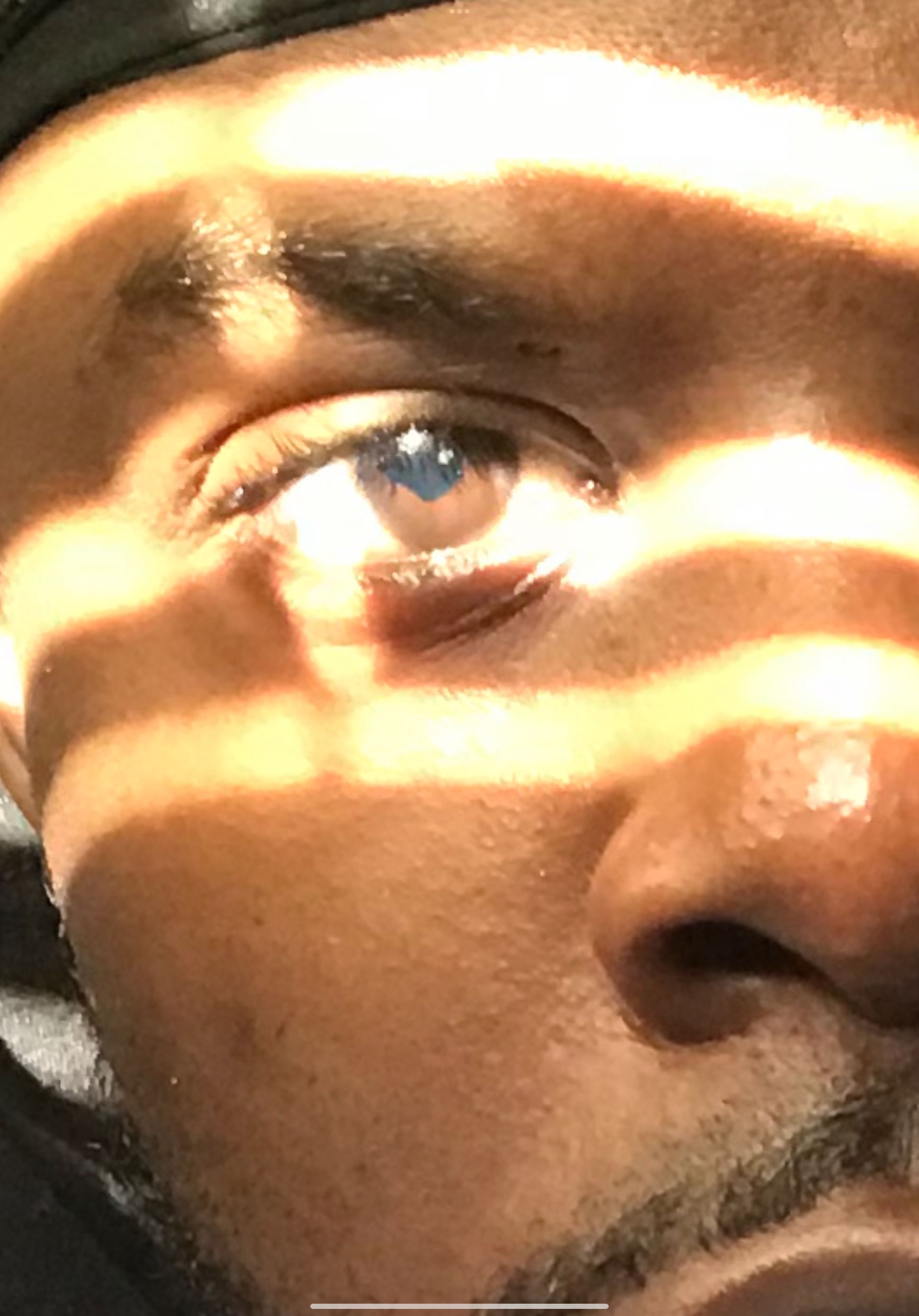 $6K for Wayne’s Cataract Removal Surgery campaign photo, 2 of 5