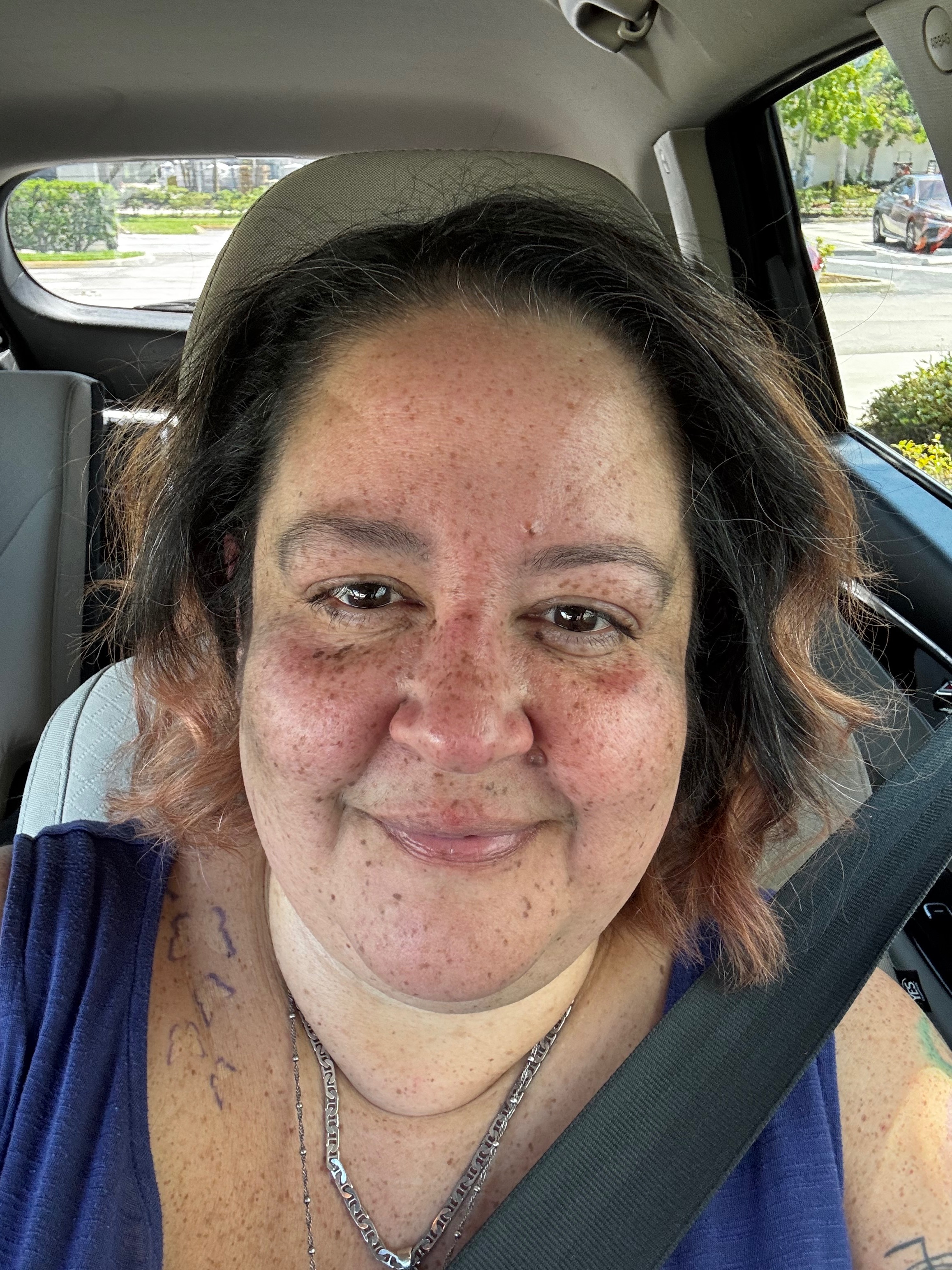 Ely’s Medical Recovery Fund campaign photo, 2 of 6