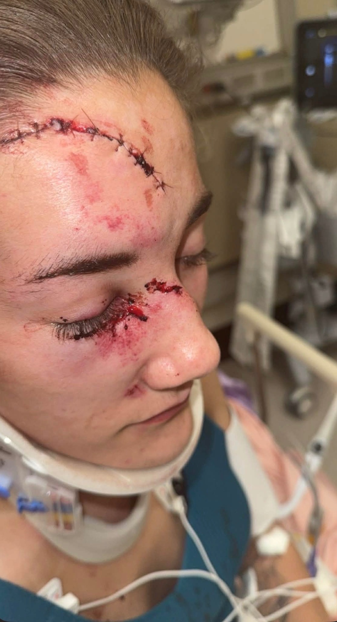 Help Gavin and Marissa Rebuild After Car Accident campaign photo, 2 of 7