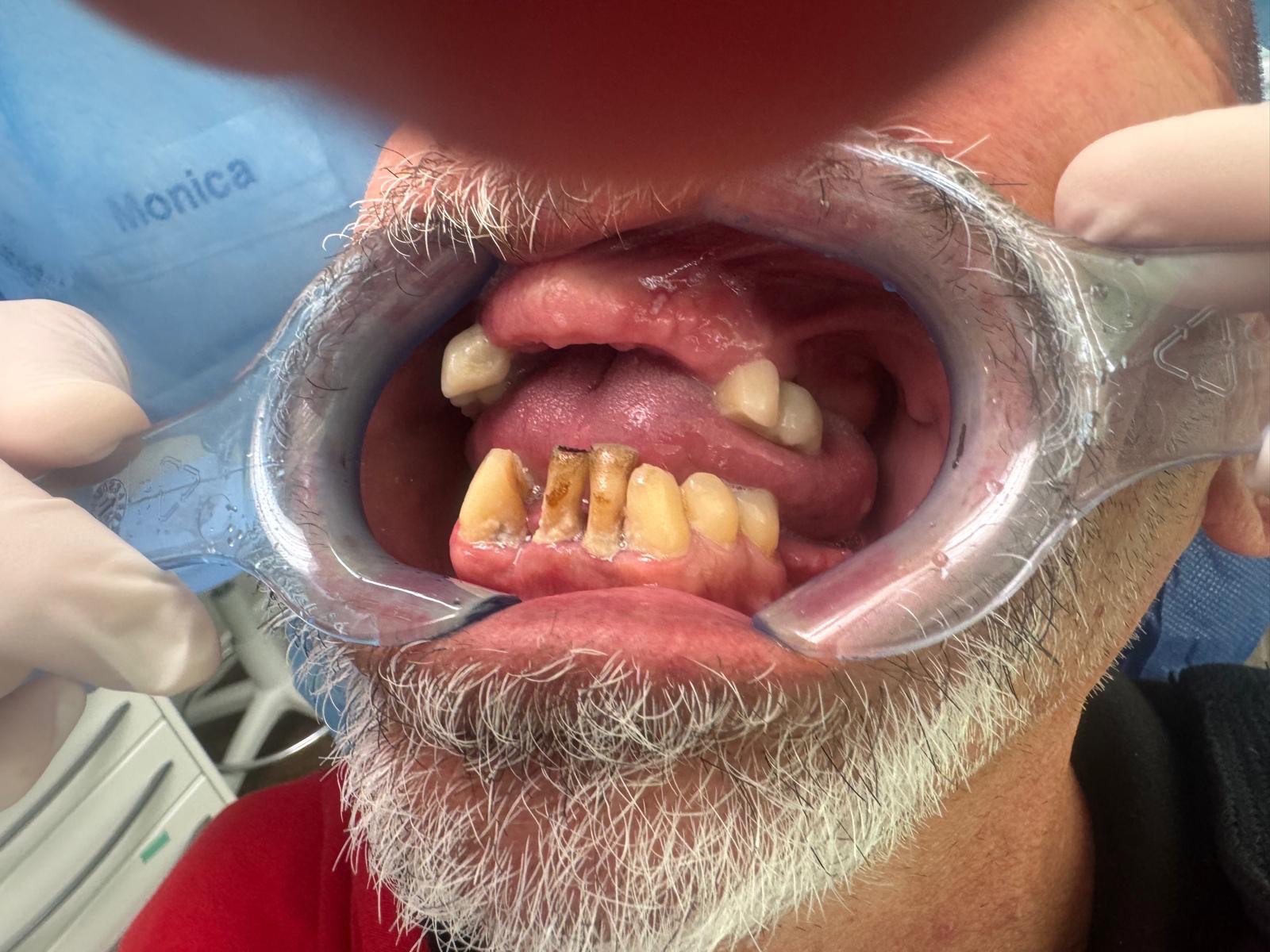 Cure dentarie campaign photo, 2 of 4