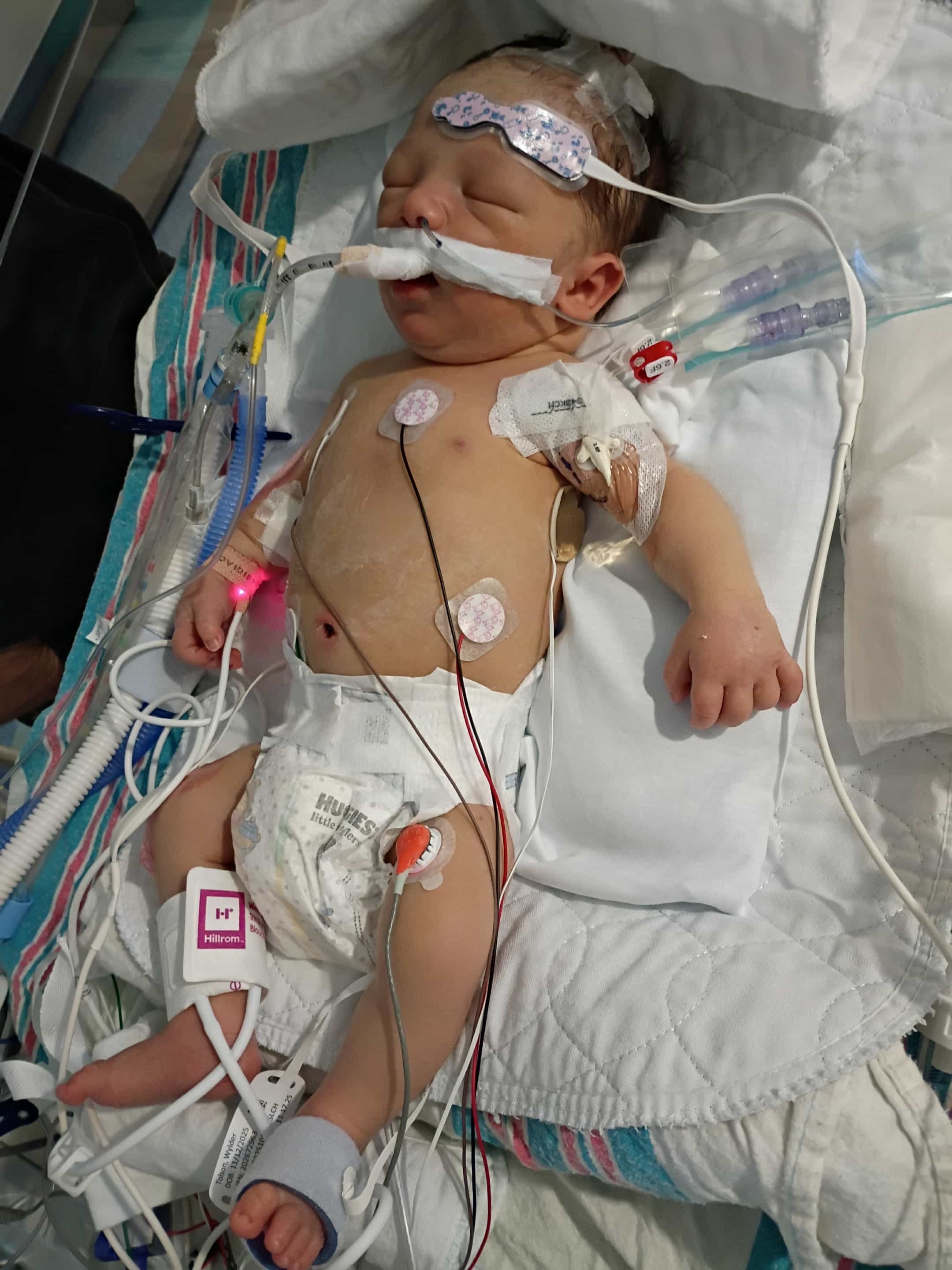Donate for Wylder's Lifesaving Surgery campaign photo, 2 of 4