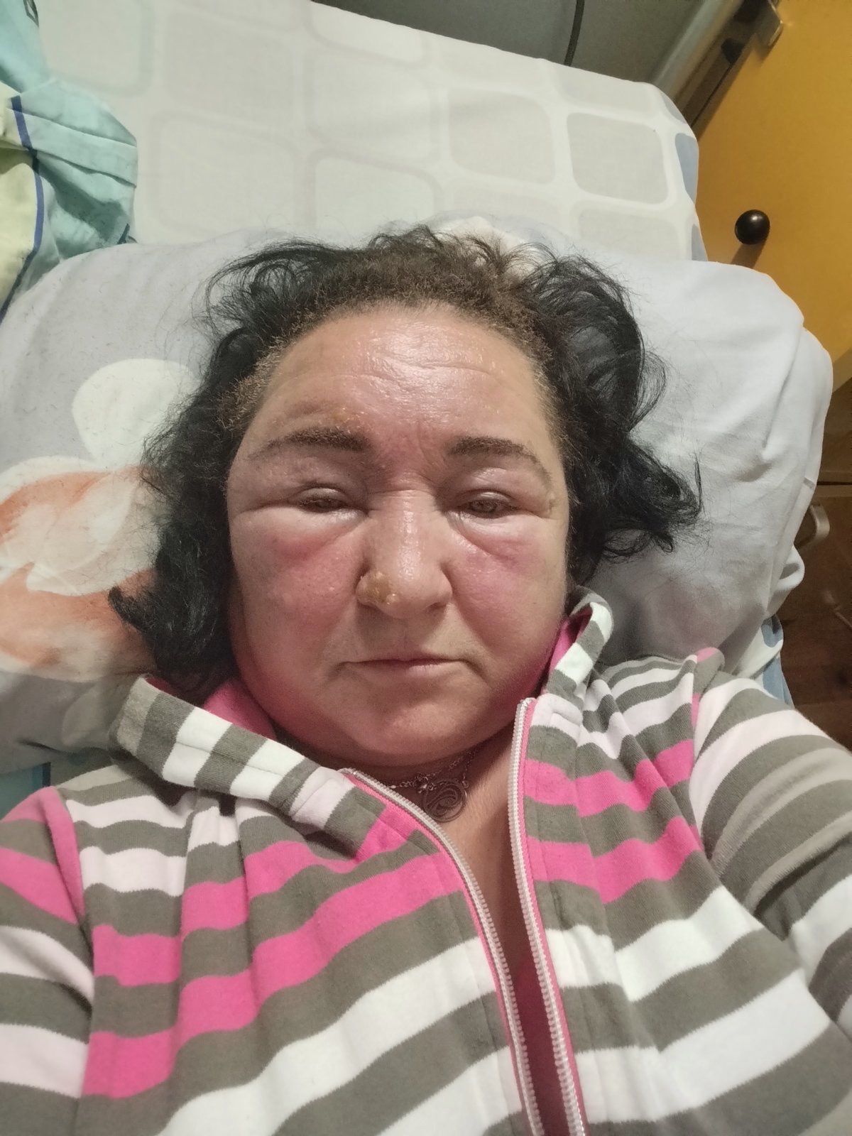 Support Our Friend's Recovery After Attack campaign photo, 5 of 6