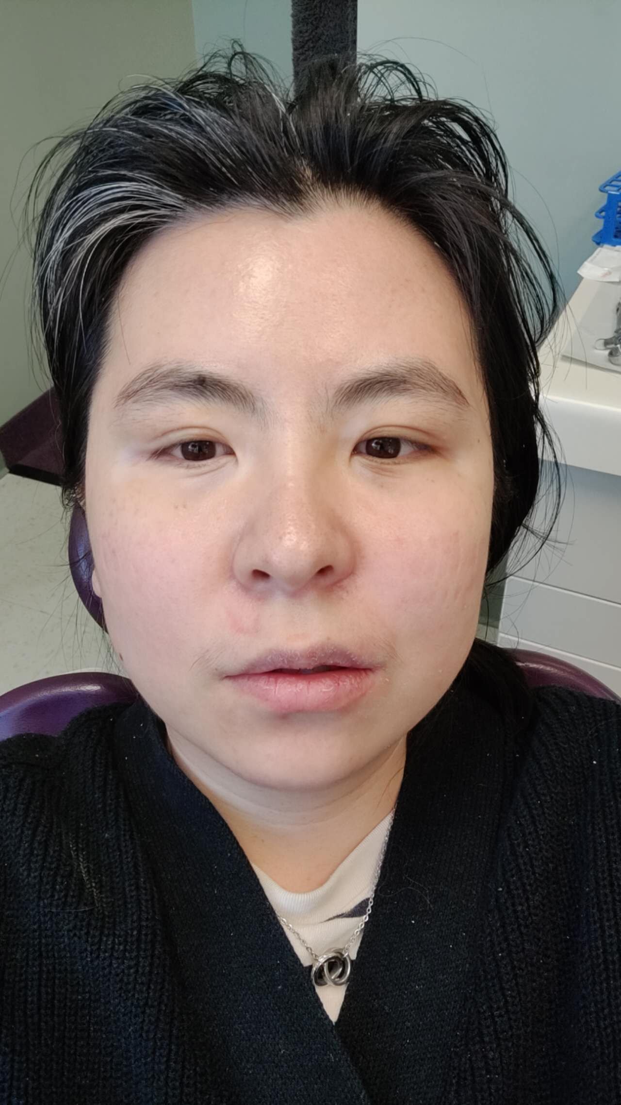 Support Chenxi's Dental Recovery and Art Journey campaign photo, 5 of 8
