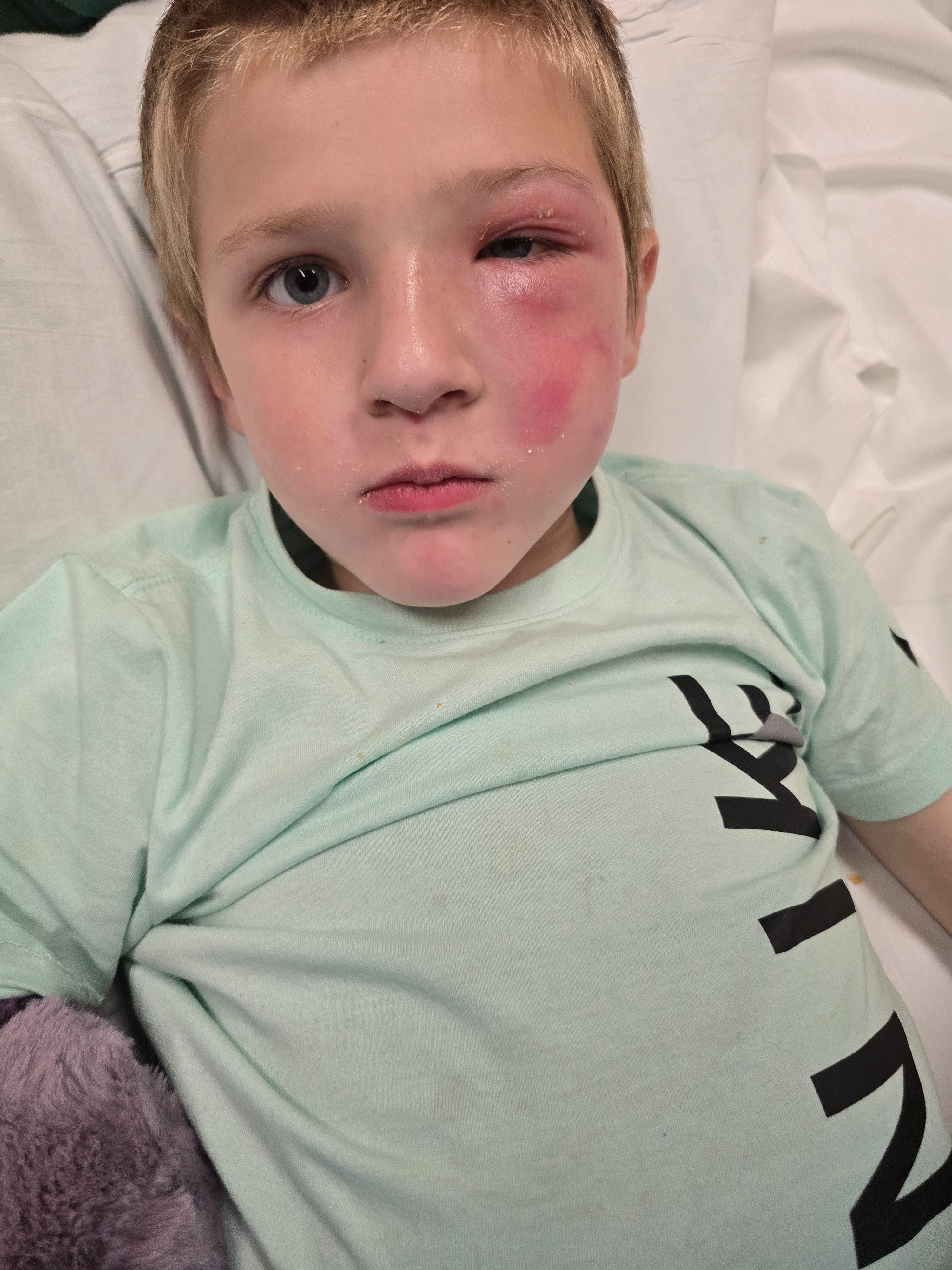 Urgent Help for Ridge's Medical Expenses campaign photo, 6 of 8