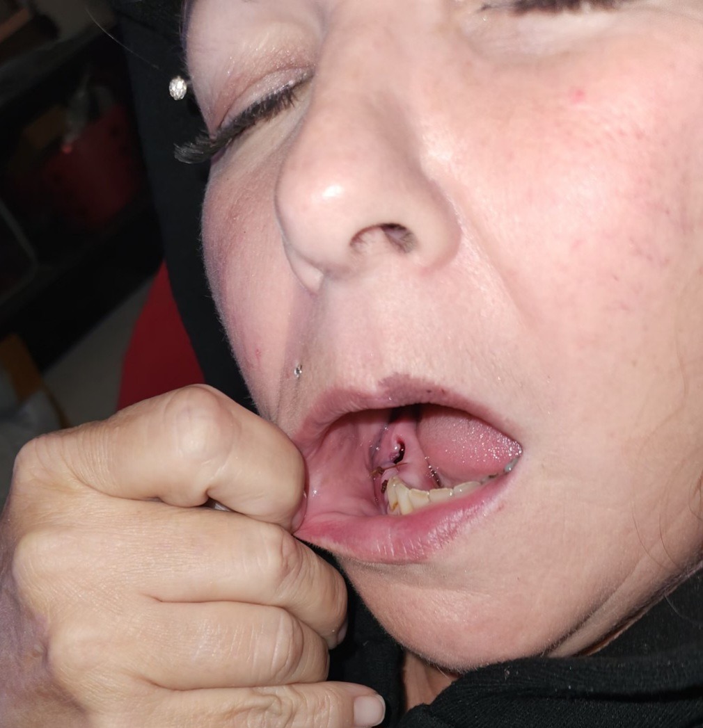 Donate to Aid Mom's Medical Recovery campaign photo, 6 of 7
