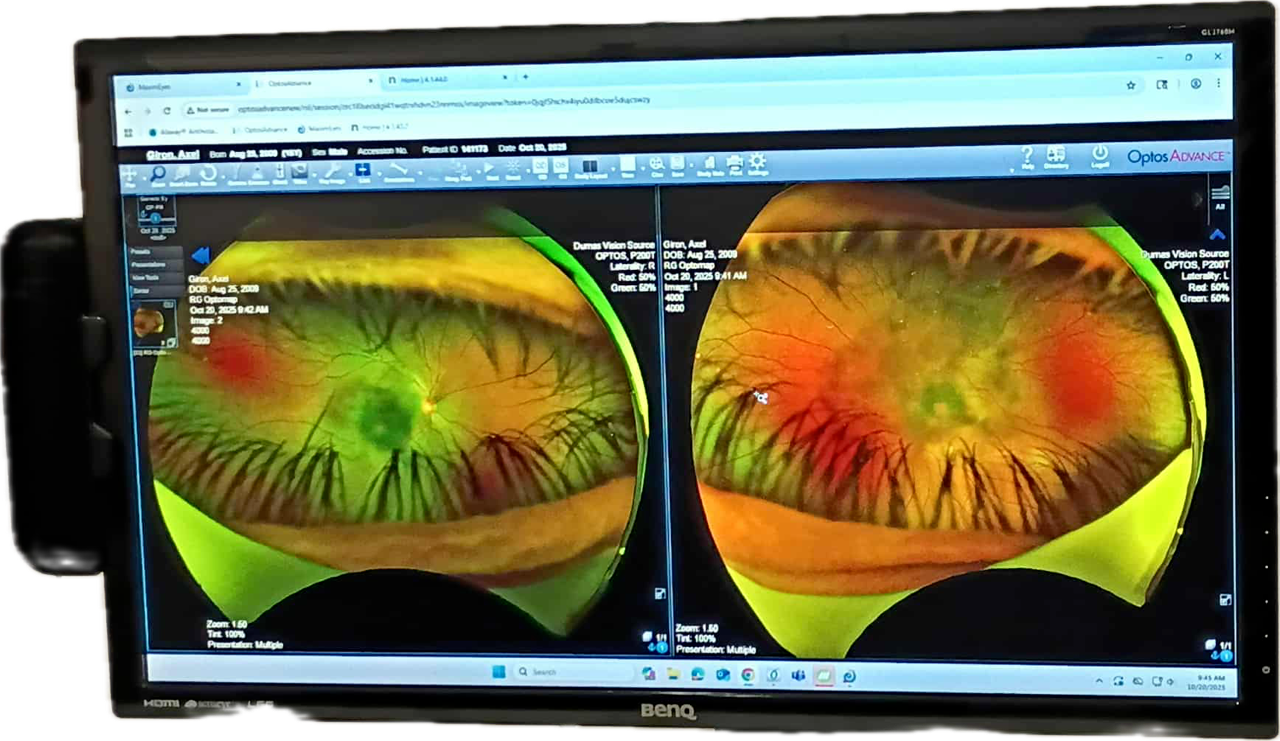 Help My 16-Year-Old Brother Save His Vision campaign photo, 2 of 6
