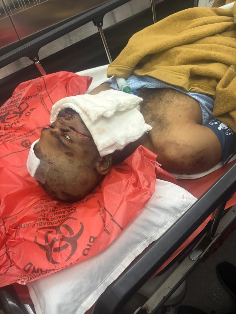 Help a 23-Year-Old Recover After a Devastating Accident, campaign photo, 2 of 5