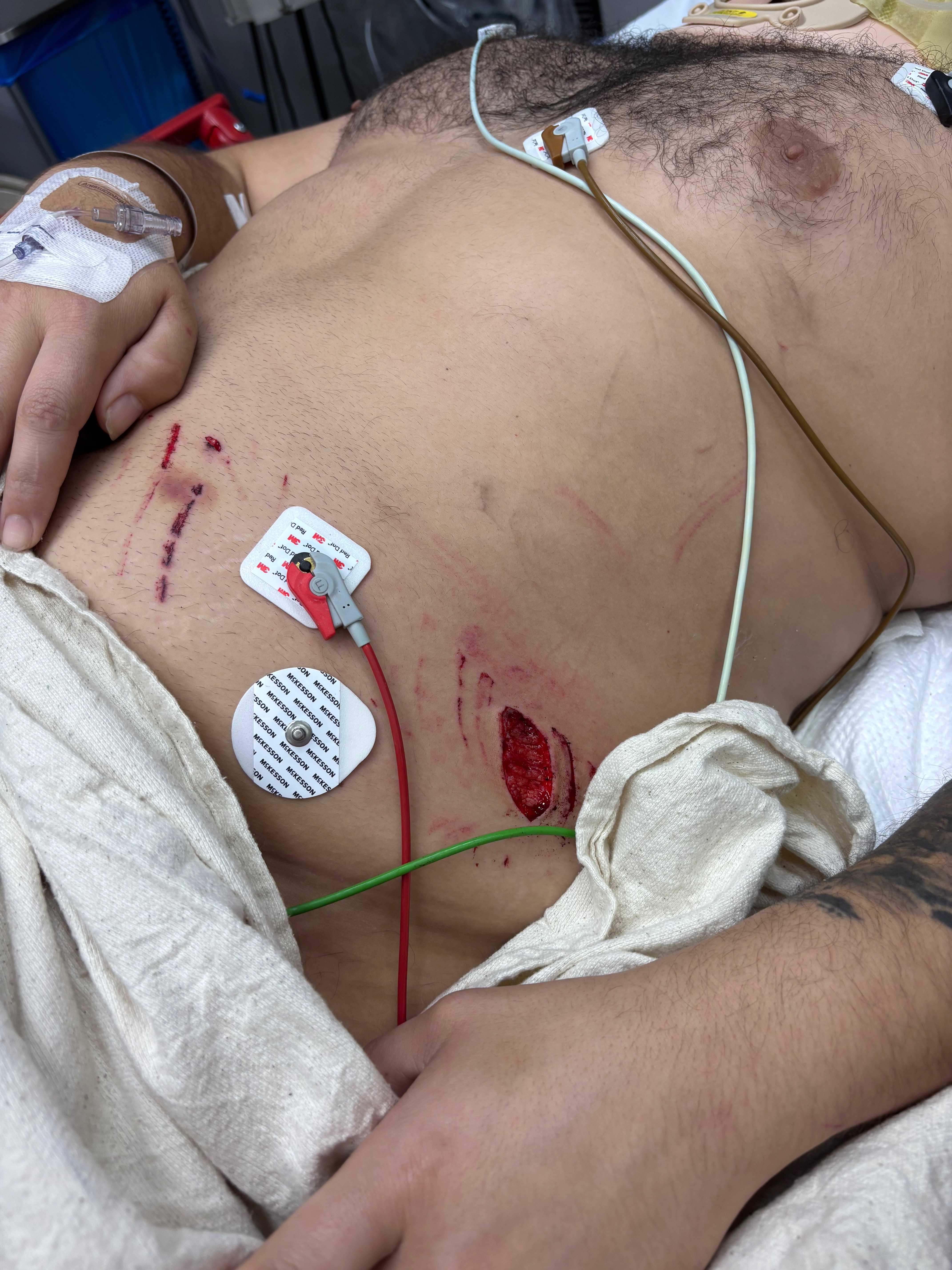 Support Marvin’s Recovery After Accident campaign photo, 5 of 8
