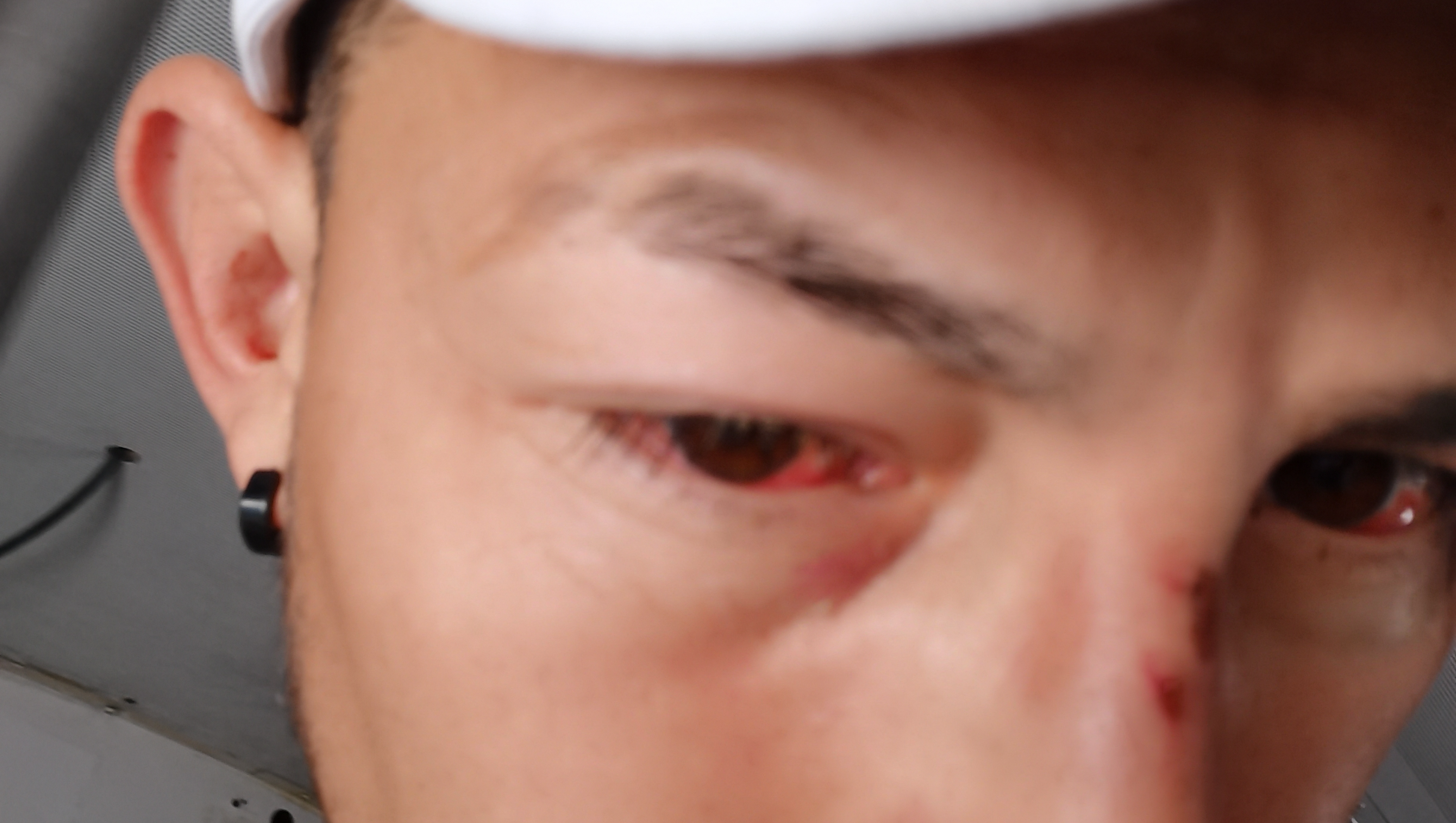 Necesito para aserme unas operaciones ya que me golpearon photo