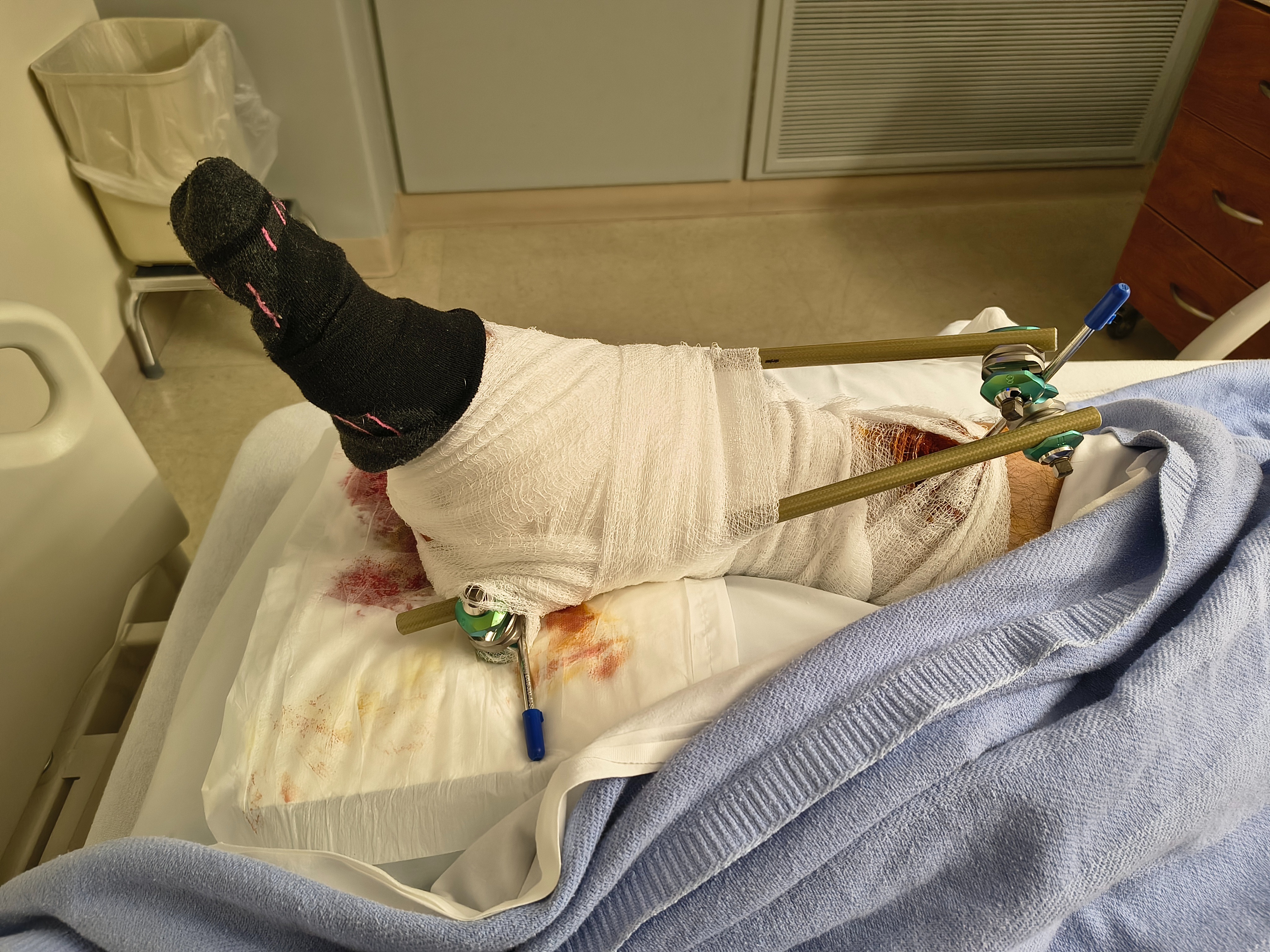 Help Seth Boomhover Heal and Support His Family campaign photo, 2 of 8
