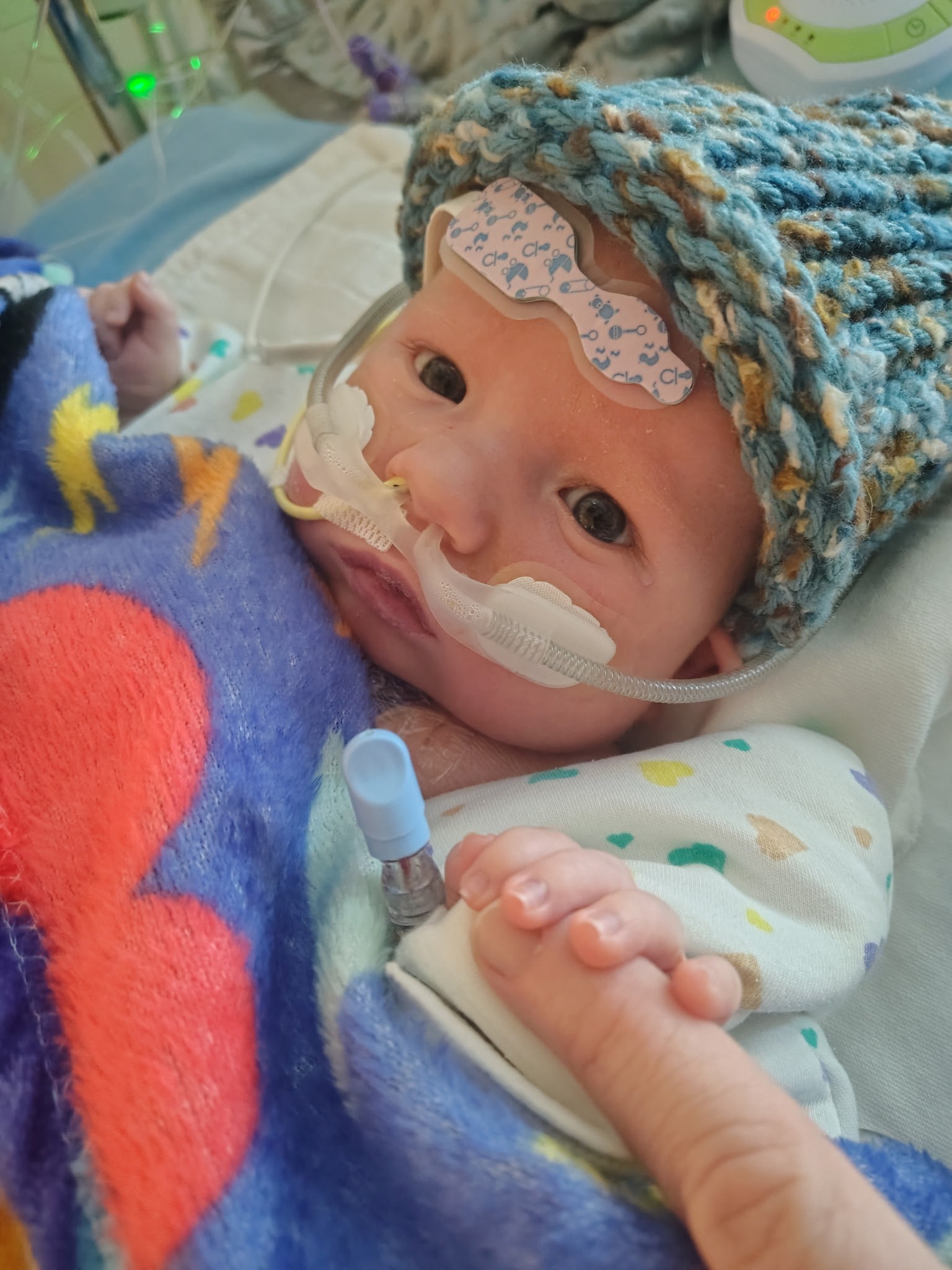 Support Baby Ryan's Heart Transplant Journey campaign photo, 2 of 4