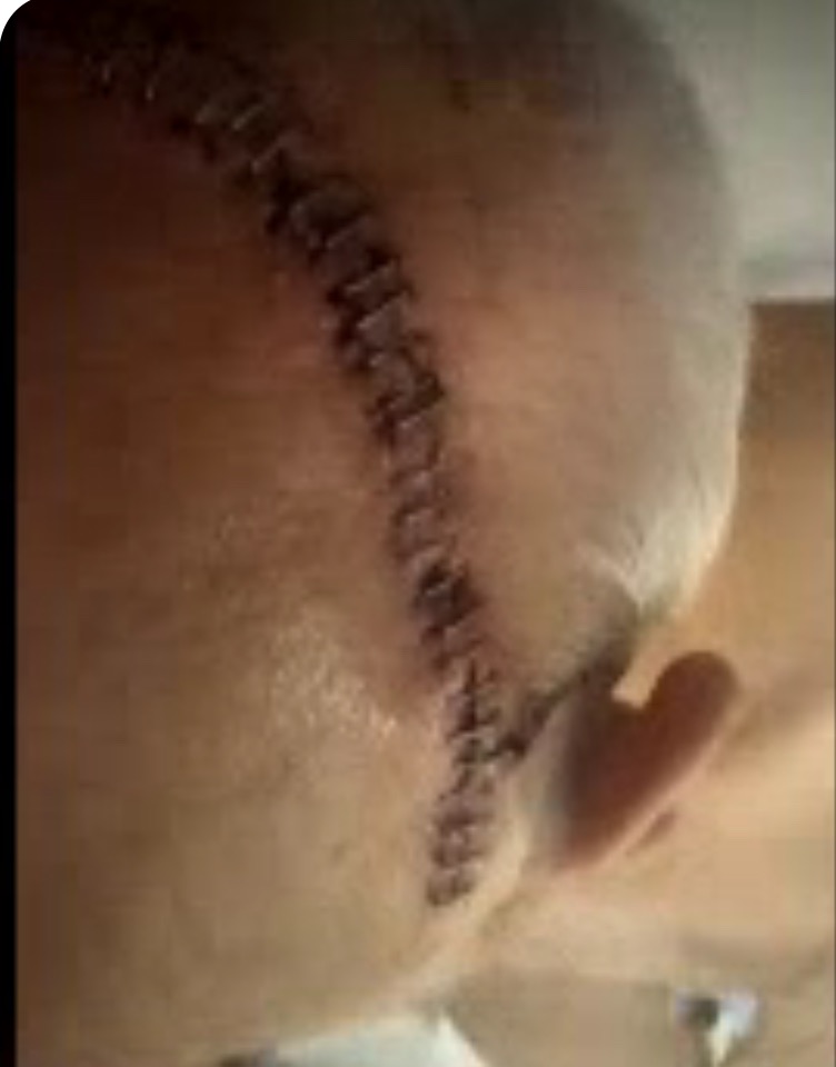 Support Jeff & Nickie Holper After Accident campaign photo, 6 of 6