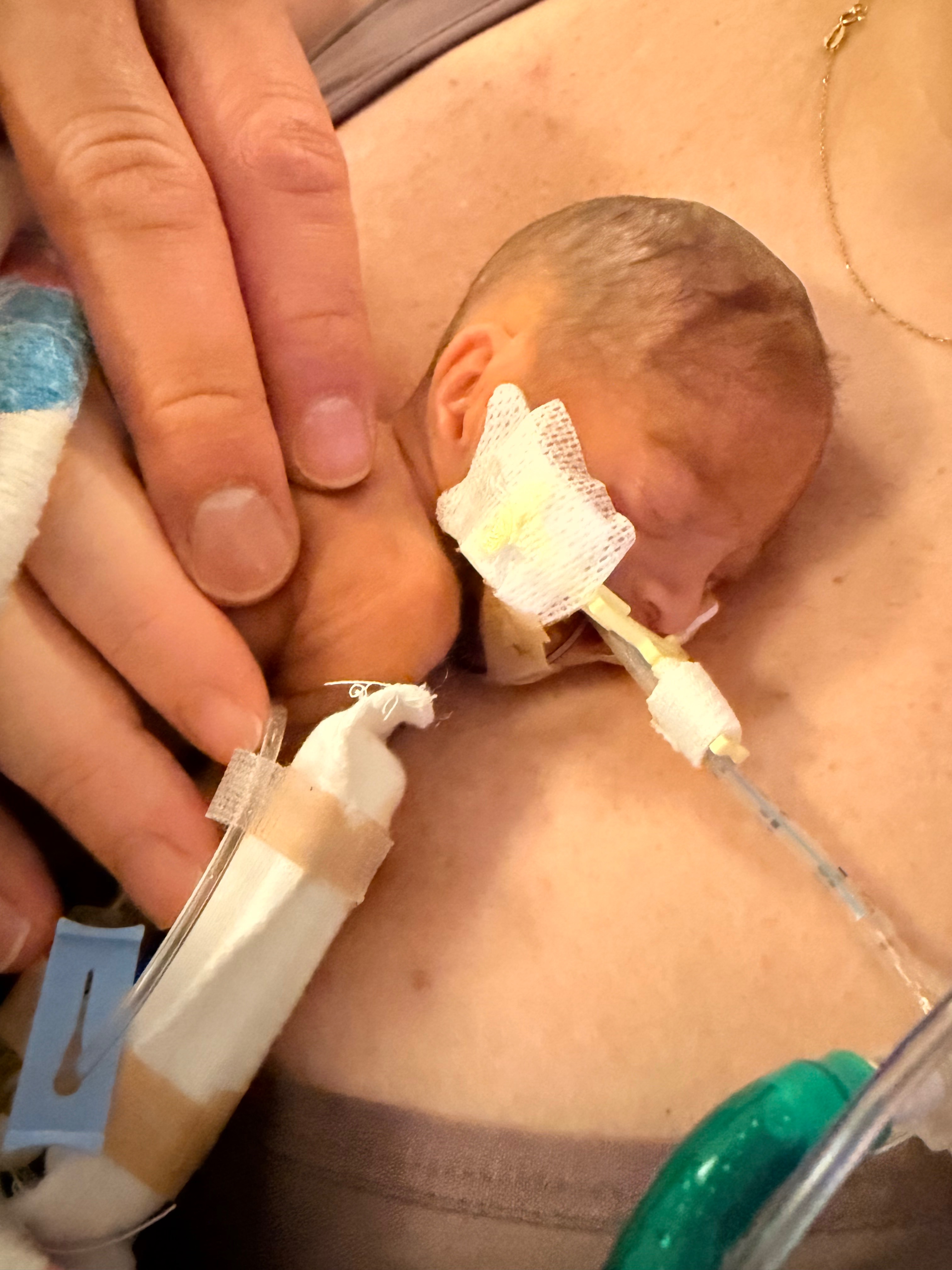 Support Anderson's Fight for Life campaign photo, 2 of 6
