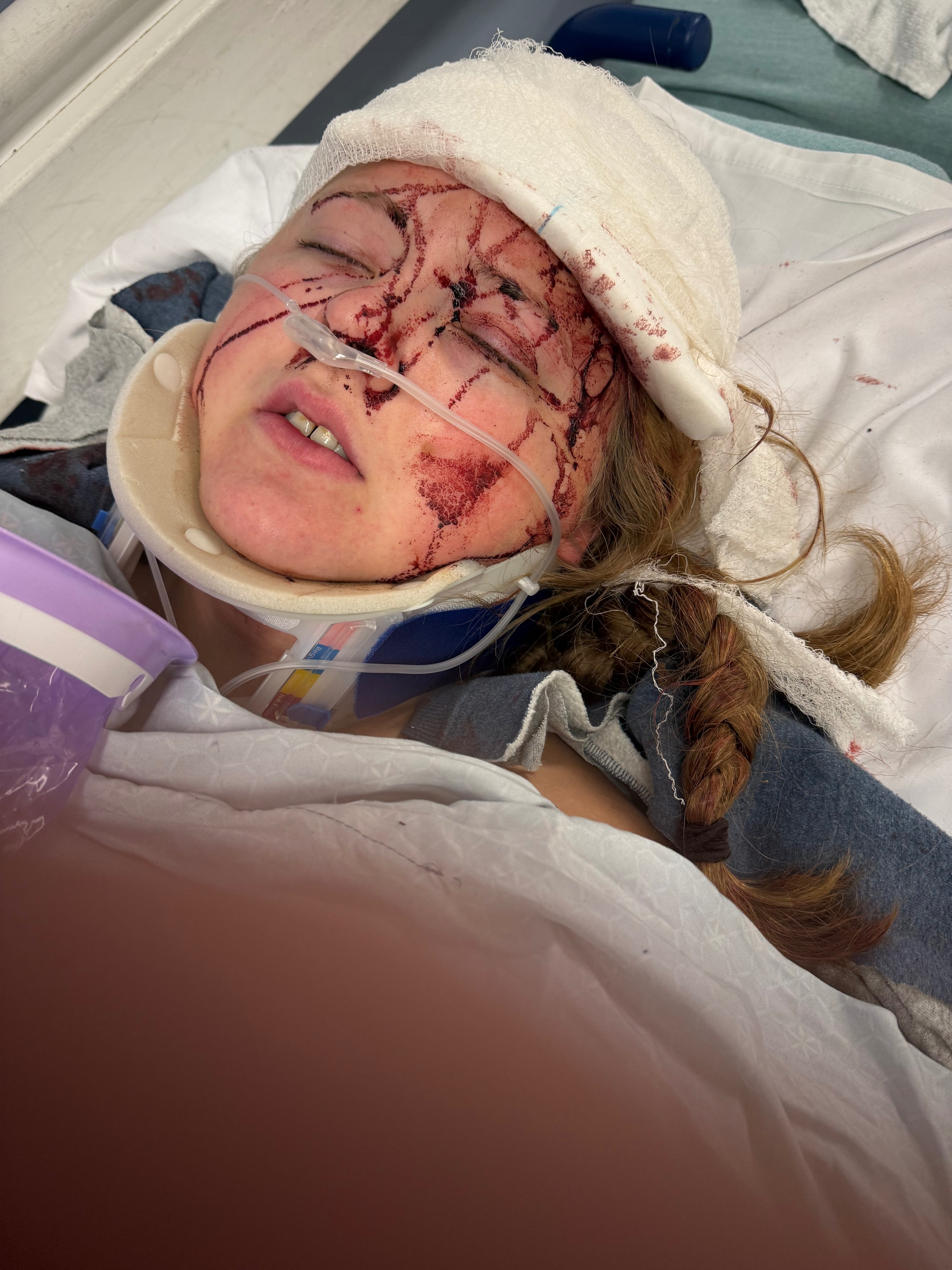 Help Newlyweds Heal After Tragic Accident campaign photo, 4 of 6
