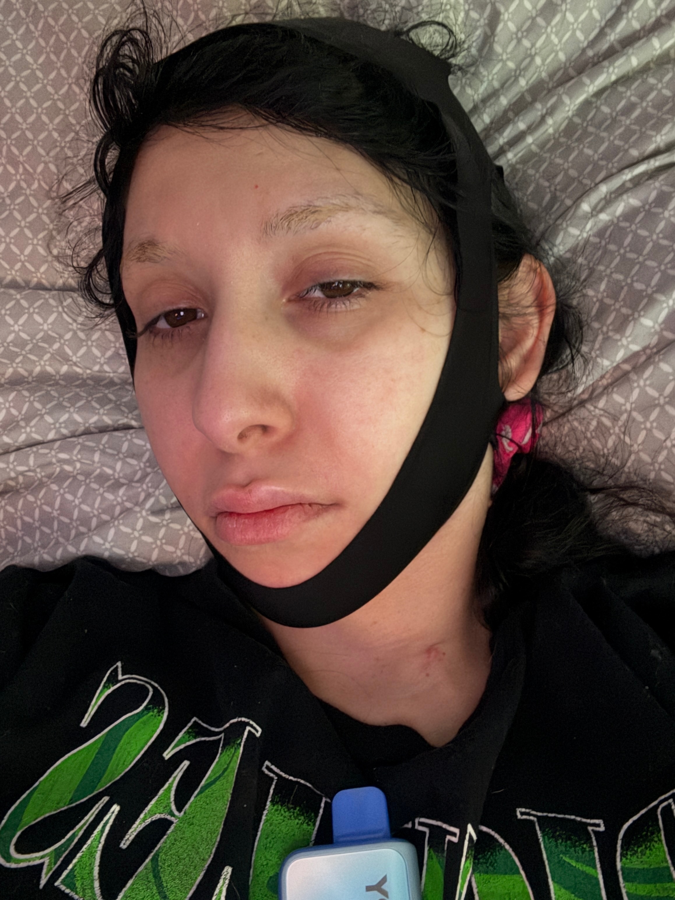Support for Tumor Removal, ICU COPays, and Power Wheelchair campaign photo, 4 of 8