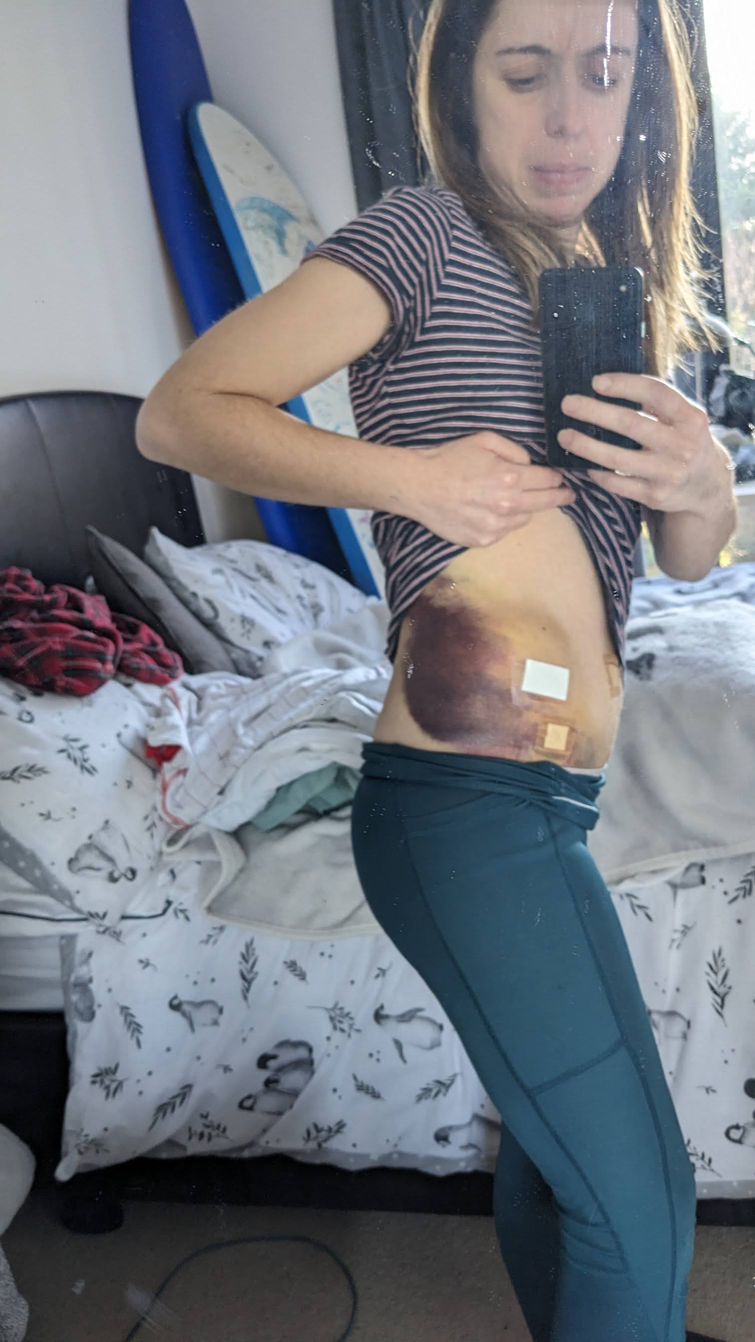 Help Nat Run Again! campaign photo, 6 of 13
