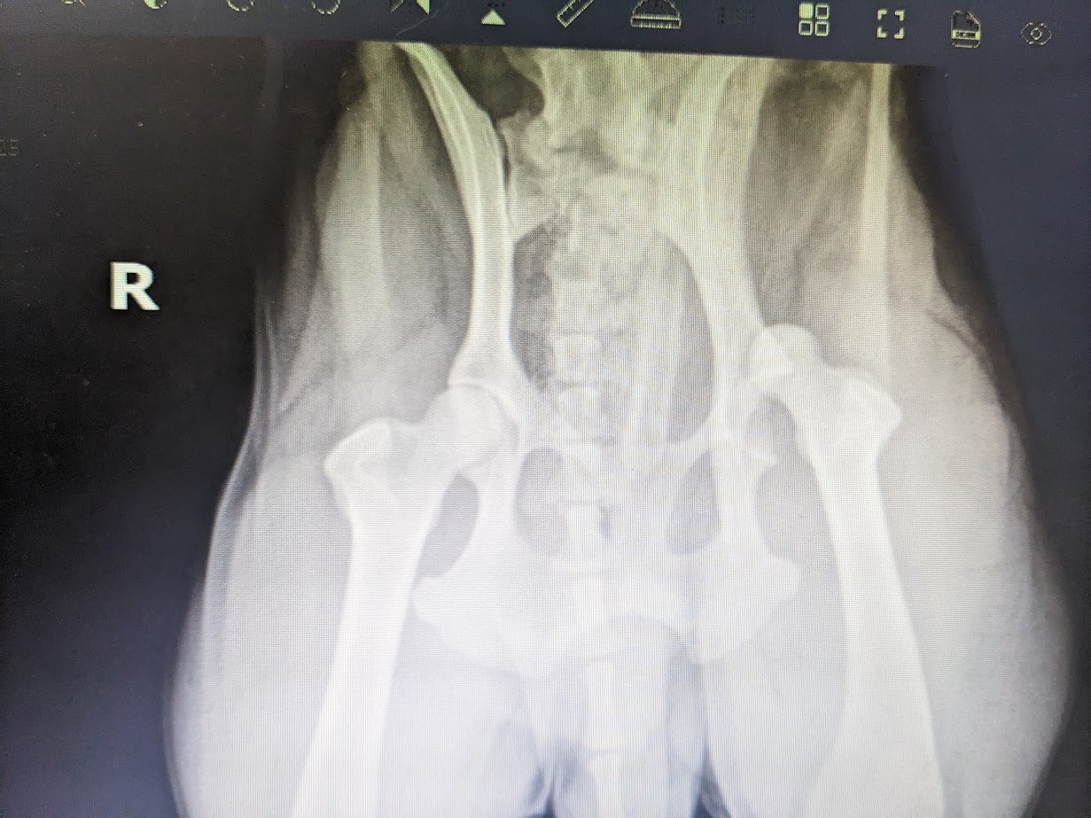 Bear's dislocated hip (FHO) surgery. campaign photo, 5 of 7
