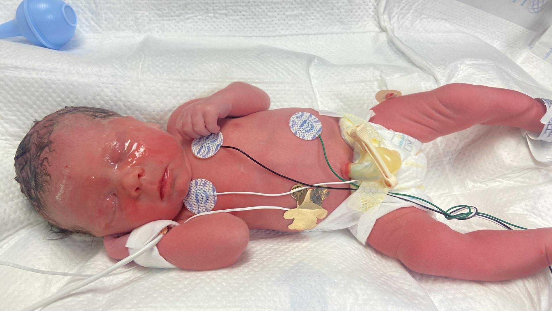 Support Mackenzie & Amayiah’s NICU Journey campaign photo, 2 of 5