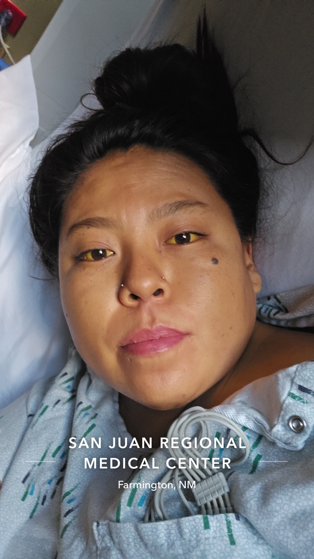 Support Queshaunda Lopez's Liver Transplant Journey campaign photo, 5 of 6