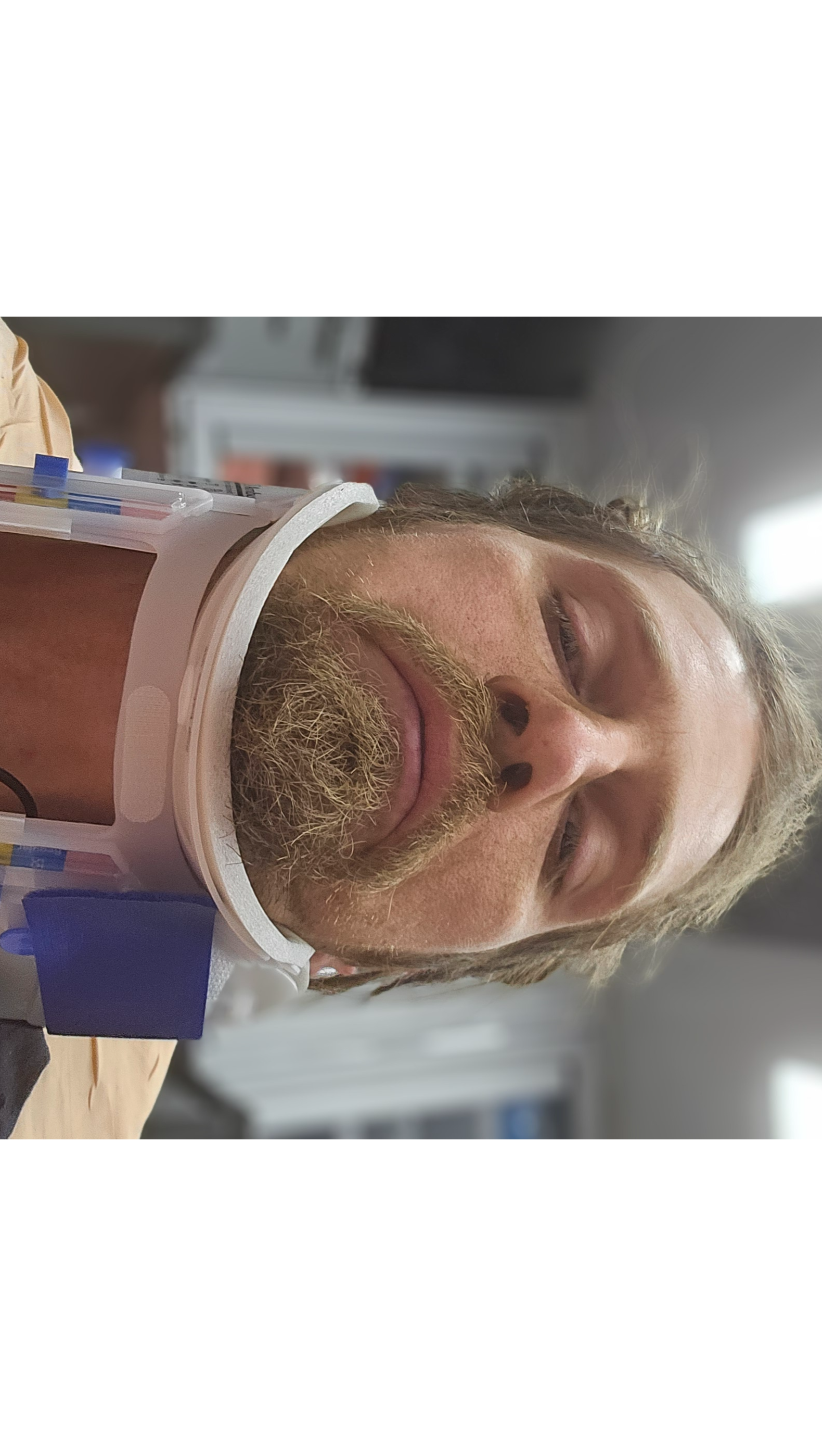 Help Jeremy Recover After E-Scooter Accident photo