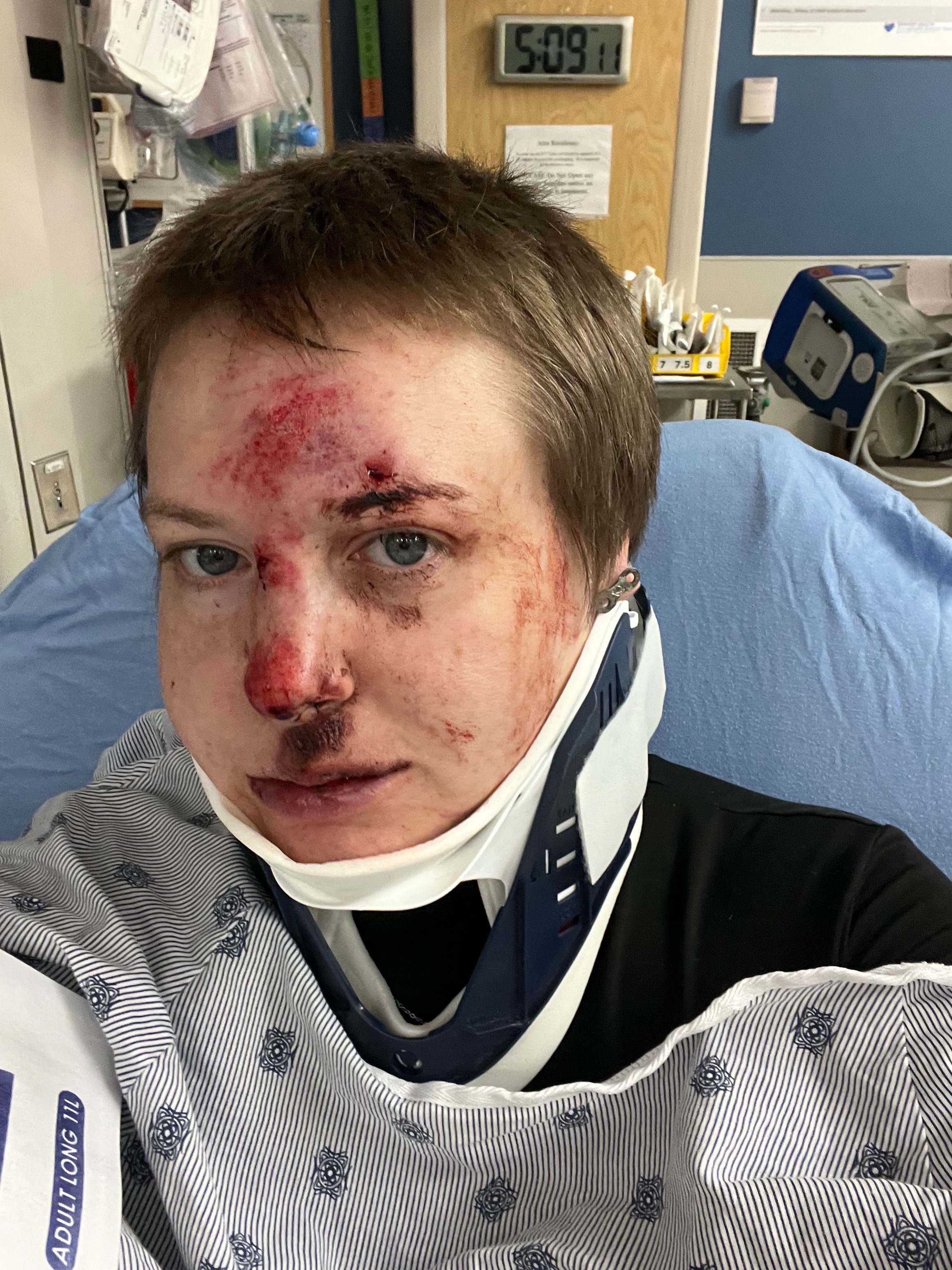 Recovering from a Scooter Accident campaign photo, 4 of 6