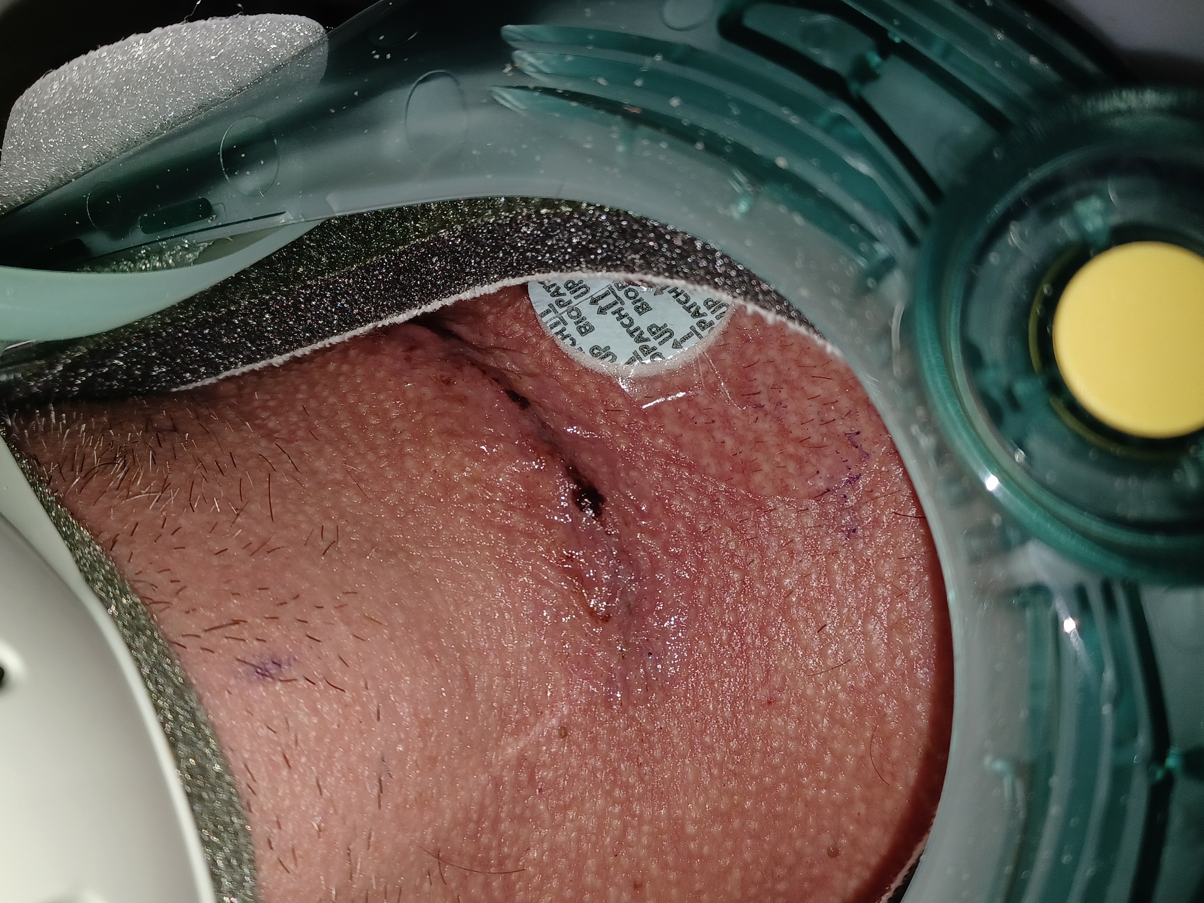 Help Dan Recover from Urgent Spine Surgery campaign photo, 2 of 6
