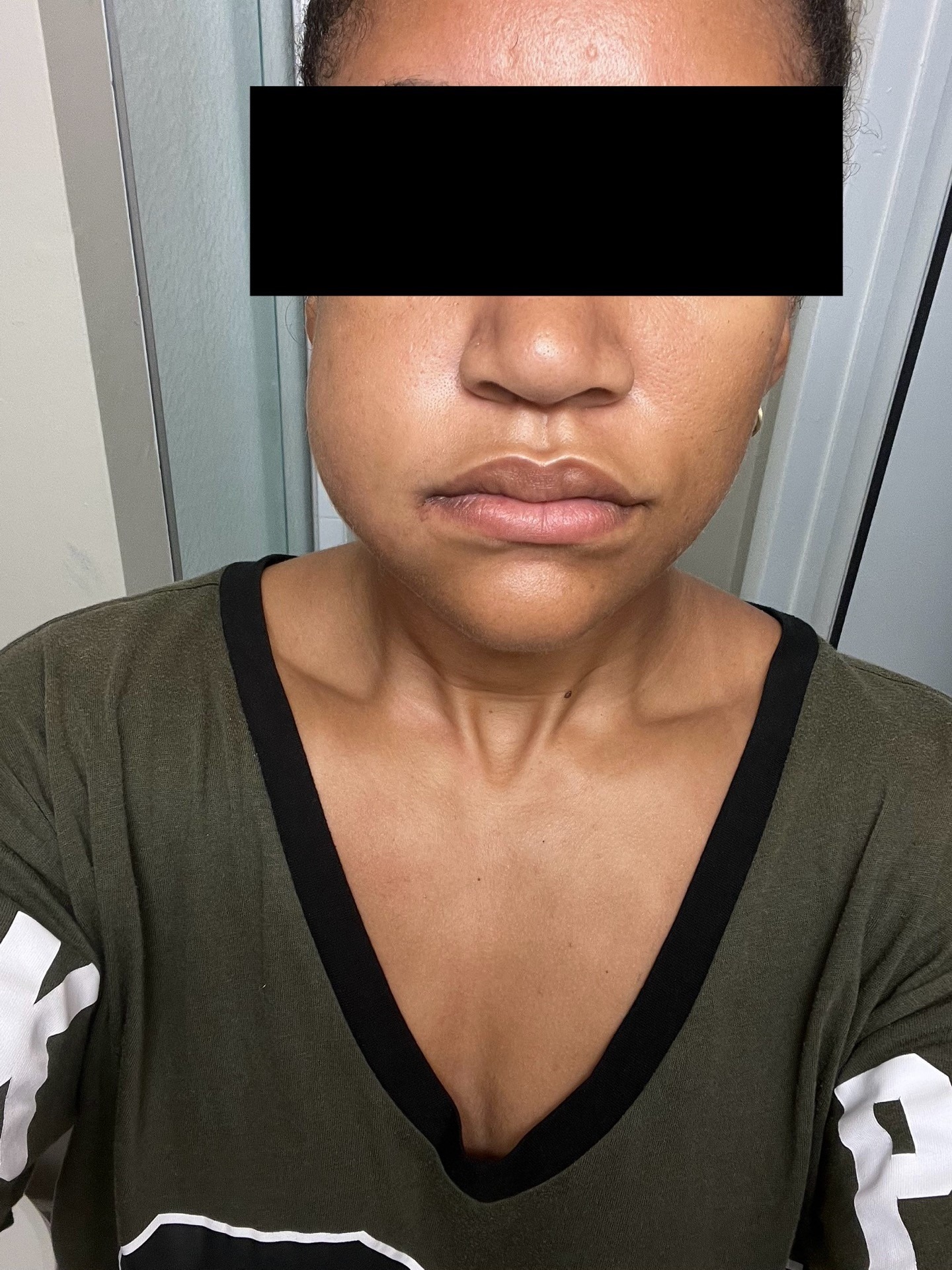 Help Our Teammate Jah Recover After a Serious Jaw Injury campaign photo, 2 of 7