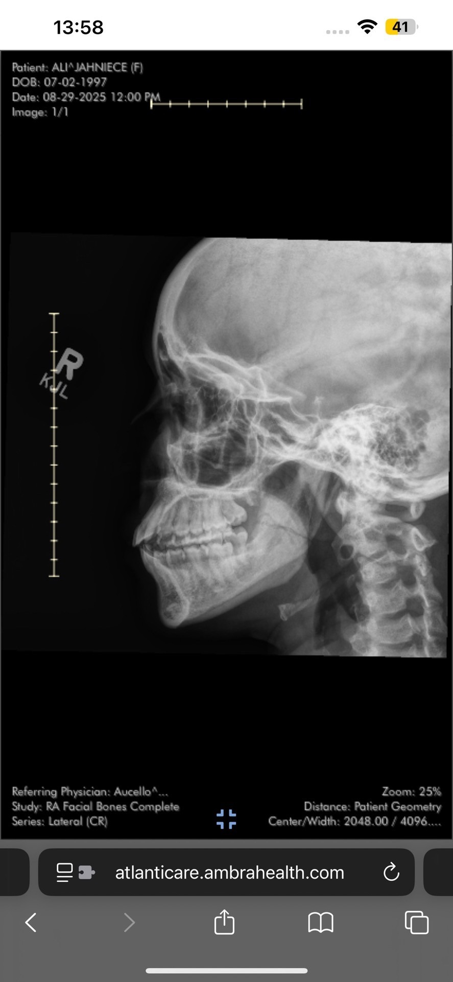 Help Our Teammate Jah Recover After a Serious Jaw Injury campaign photo, 4 of 7