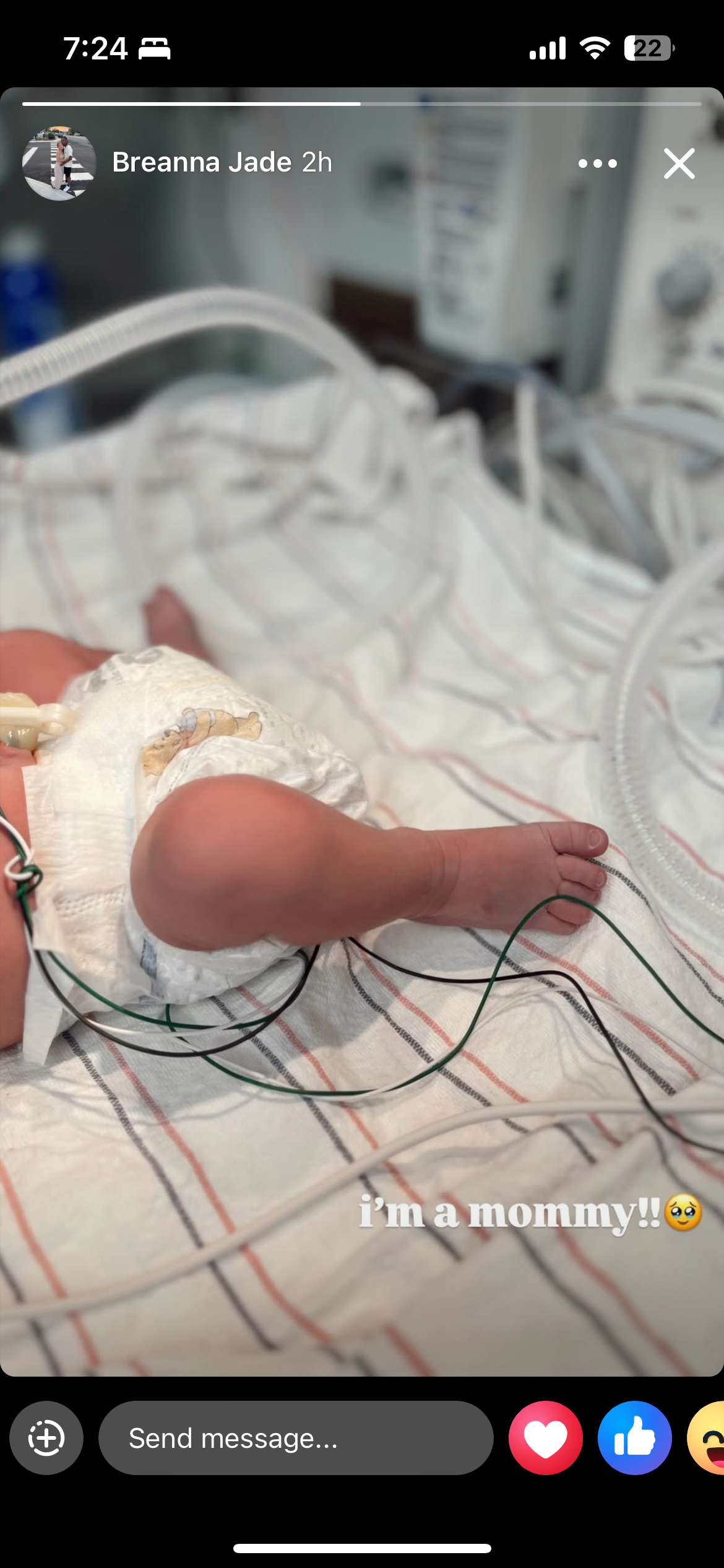 Support for Breanna’s Family - Medical Needs for Baby campaign photo, 2 of 5