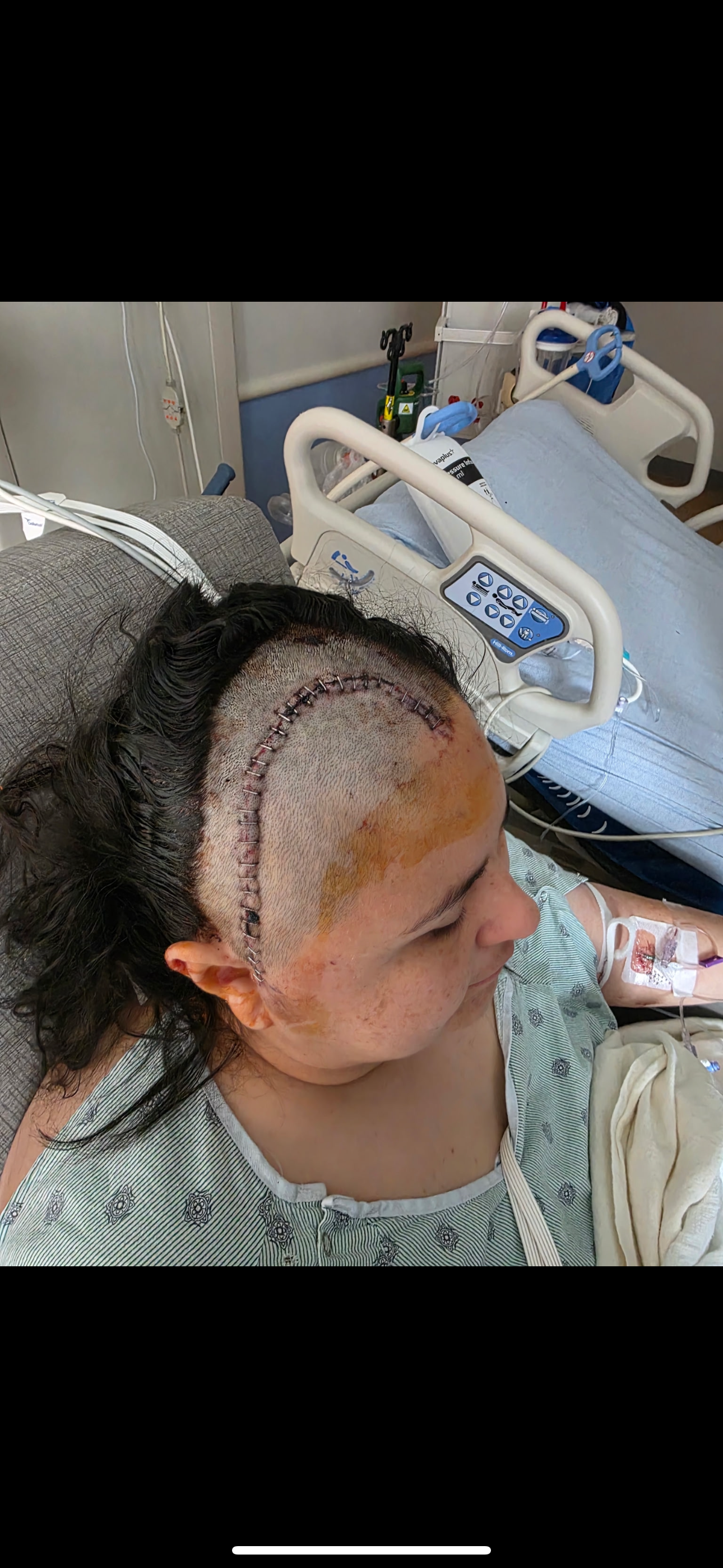 Support Rosvinda’s Recovery & Medical Expenses campaign photo, 4 of 6