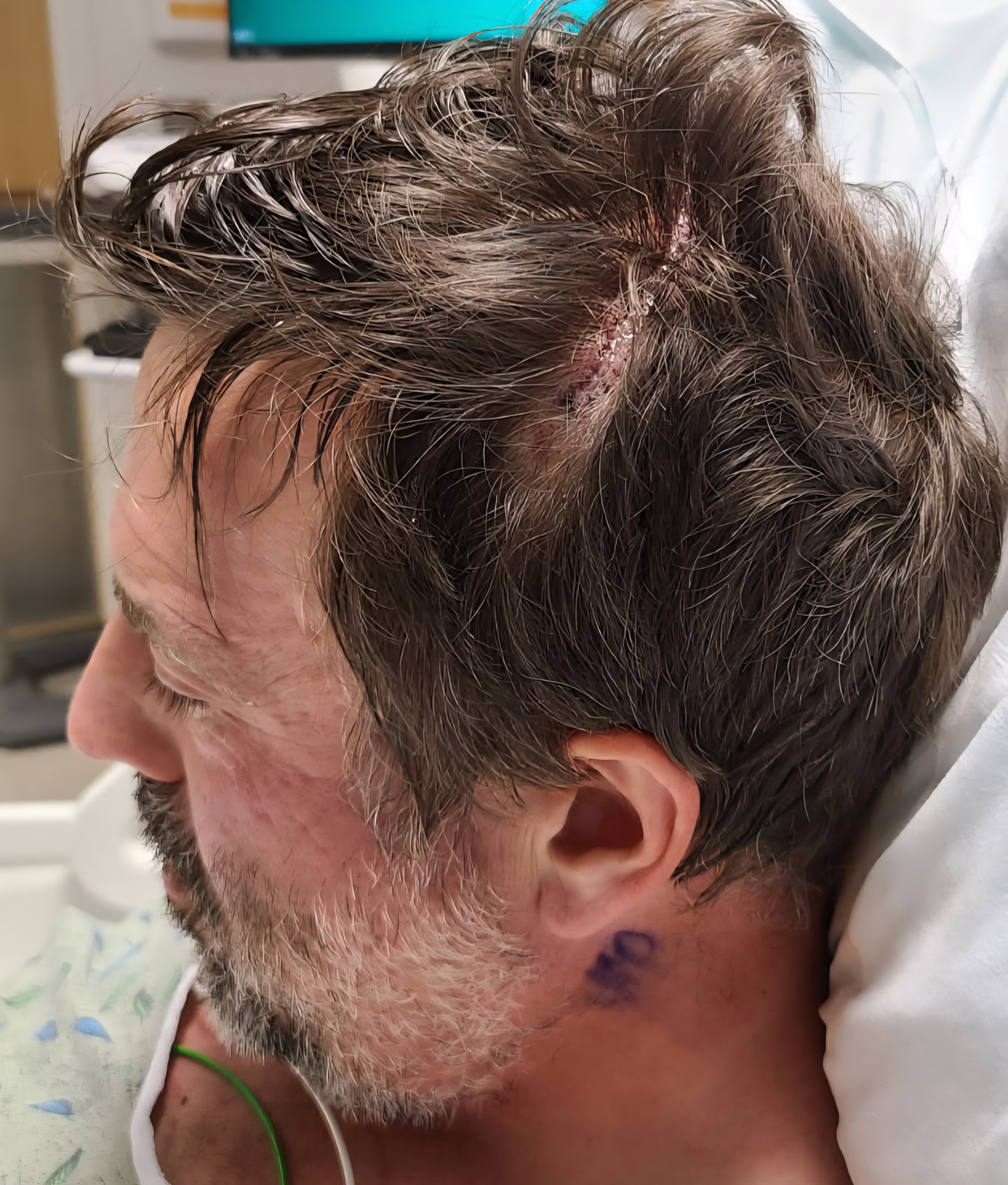 Staying Alive Until Glioblastoma Is Cured campaign photo, 5 of 8
