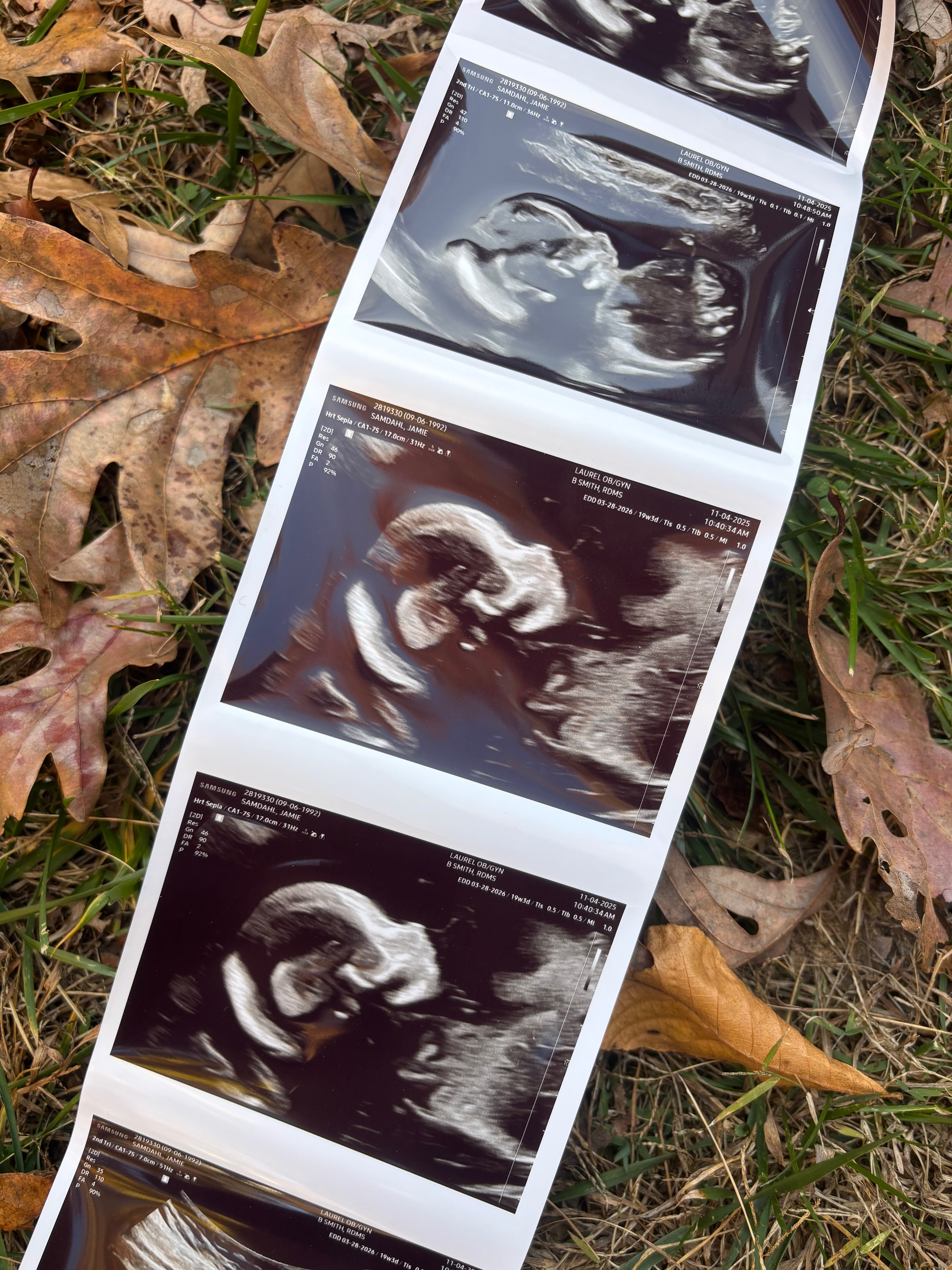 Cancer Diagnosis While Pregnant — Support for Our Family campaign photo, 4 of 4