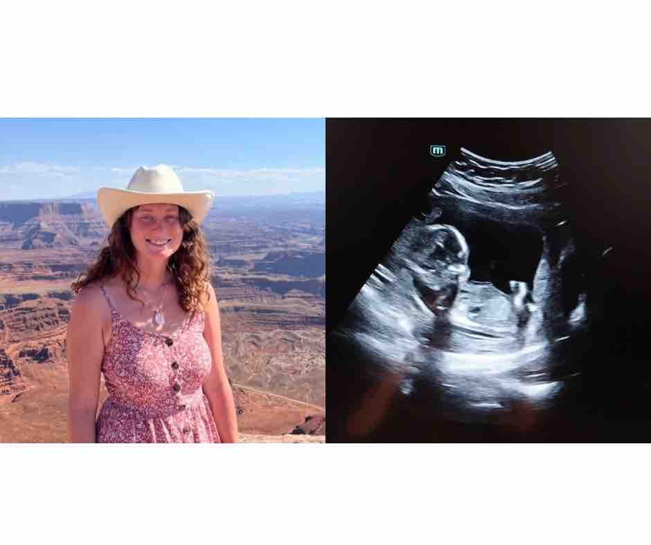 Support Heidi’s Birth & Baby Fund campaign photo, 2 of 5