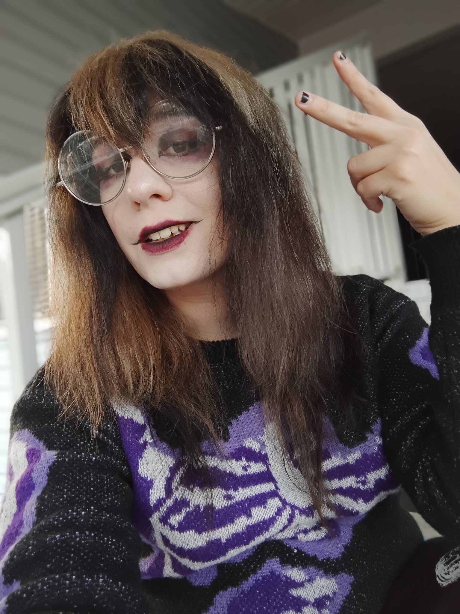 Support Kota's Journey to Facial Feminization campaign photo, 5 of 8