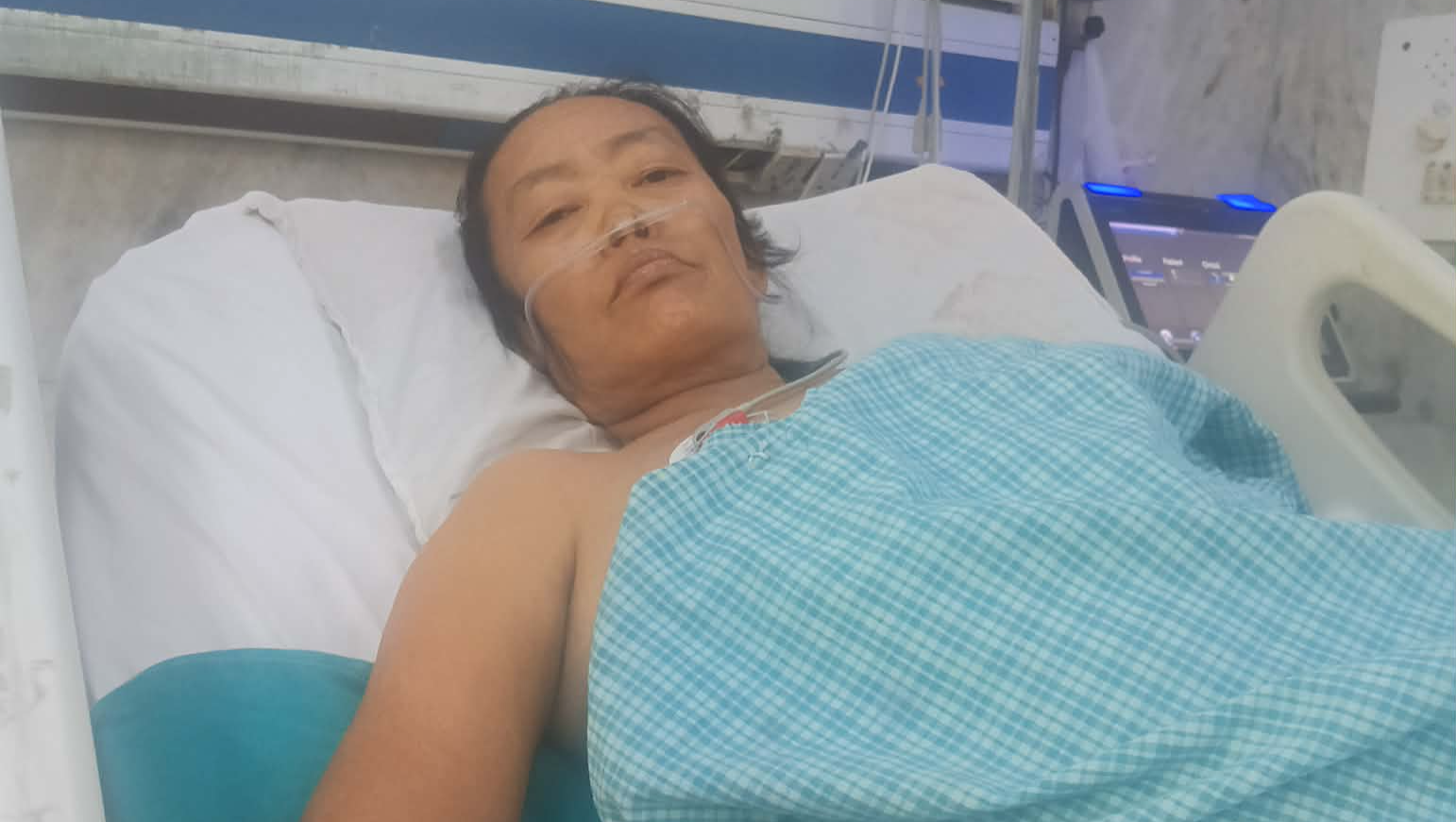 Liver transplant photo