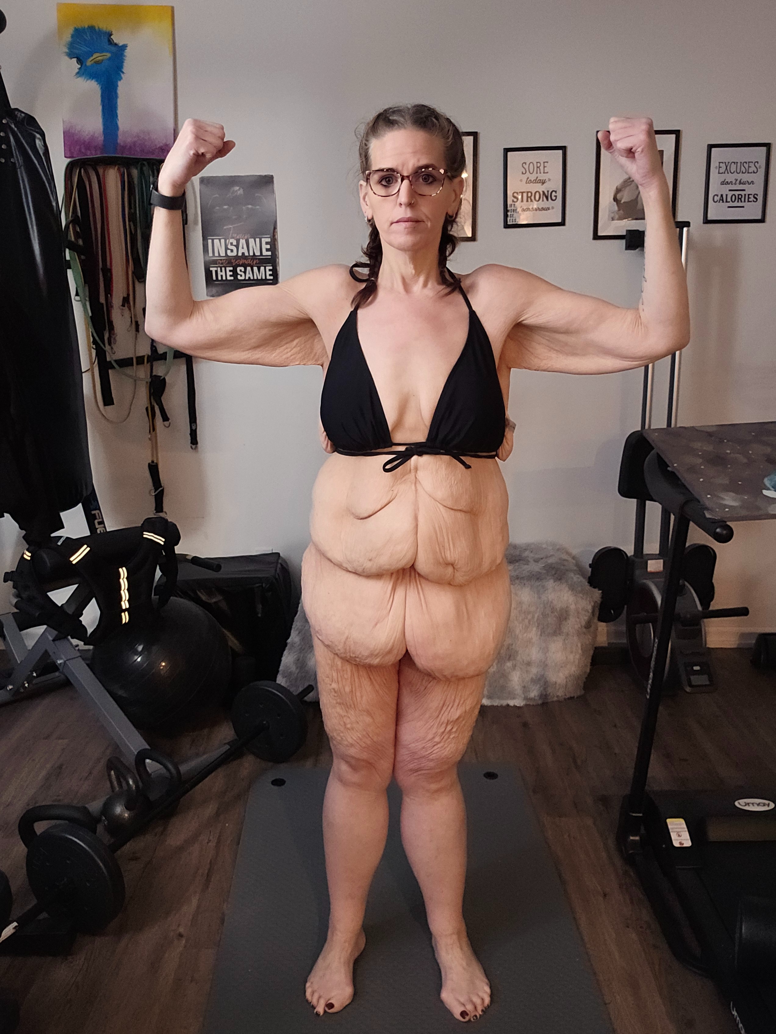 Help Jessica Achieve Her Final Surgery Goals campaign photo, 6 of 8