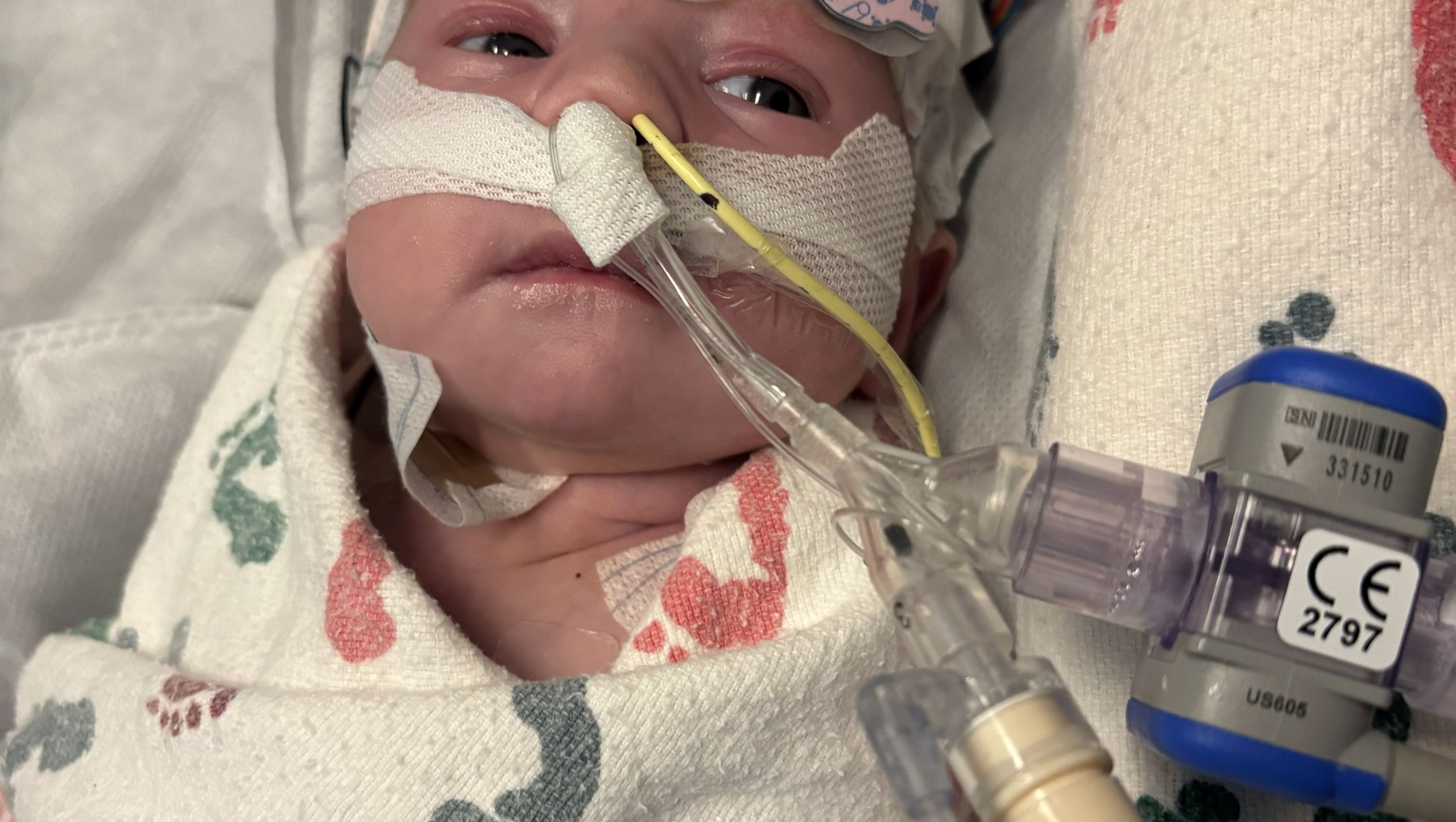 Support Little Mia's Heart Treatment