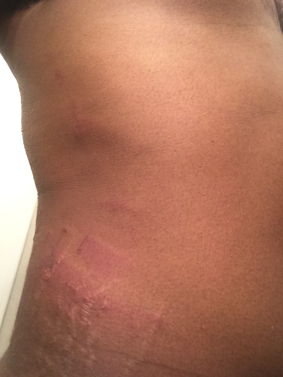 Helping Us Rebuild After a Life-Changing Assault campaign photo, 4 of 8