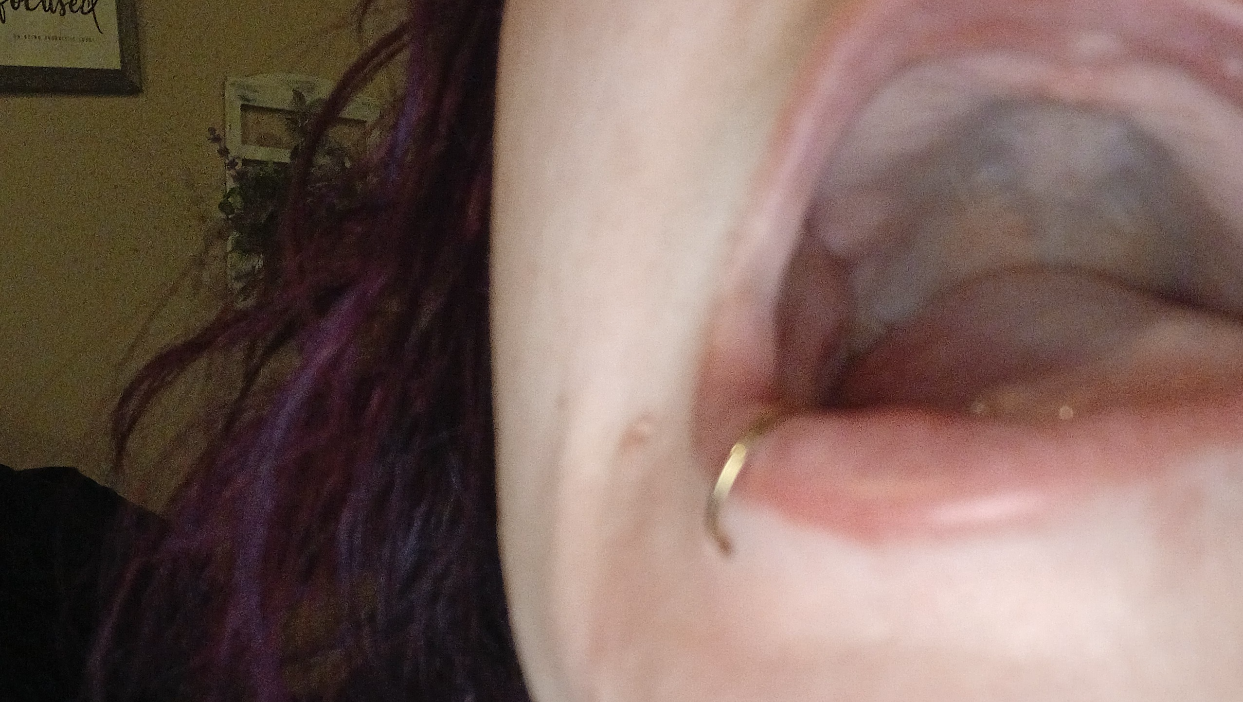 Restore Mary's Smile: Support Her Dental Journey photo